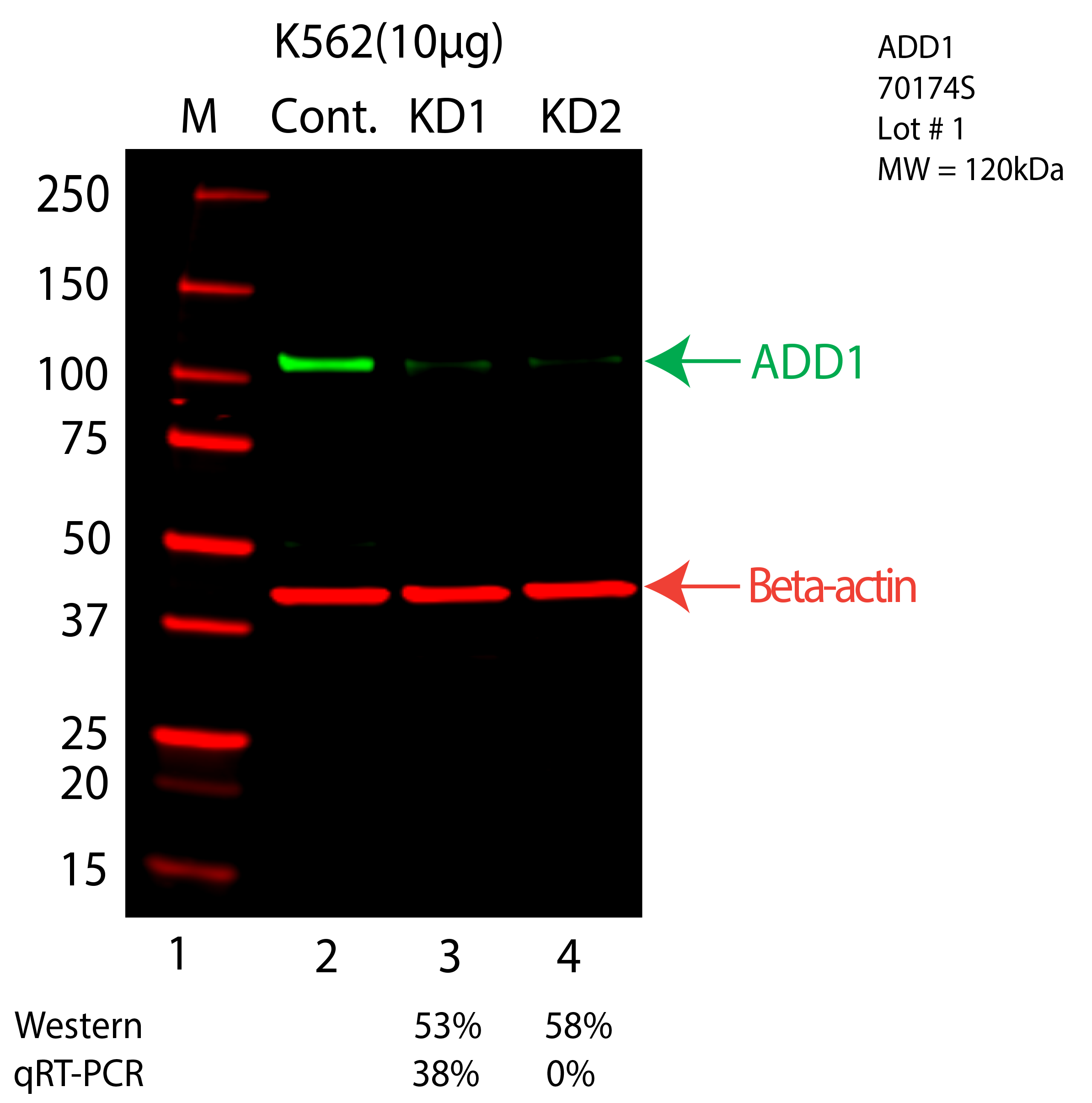 ADD1-K562-CRISPR-70174S.png<br>Caption: Western blot following CRISPR against ADD1 in K562 whole cell lysate using ADD1 specific antibody. Lane 1 is a ladder, lane 2 is K562 non-targeting control knockdown, lane 3 and 4 are two different CRISPR against ADD1. ADD1 protein appears as the green arrow, Beta-actin serves as a control and appears in red arrow.