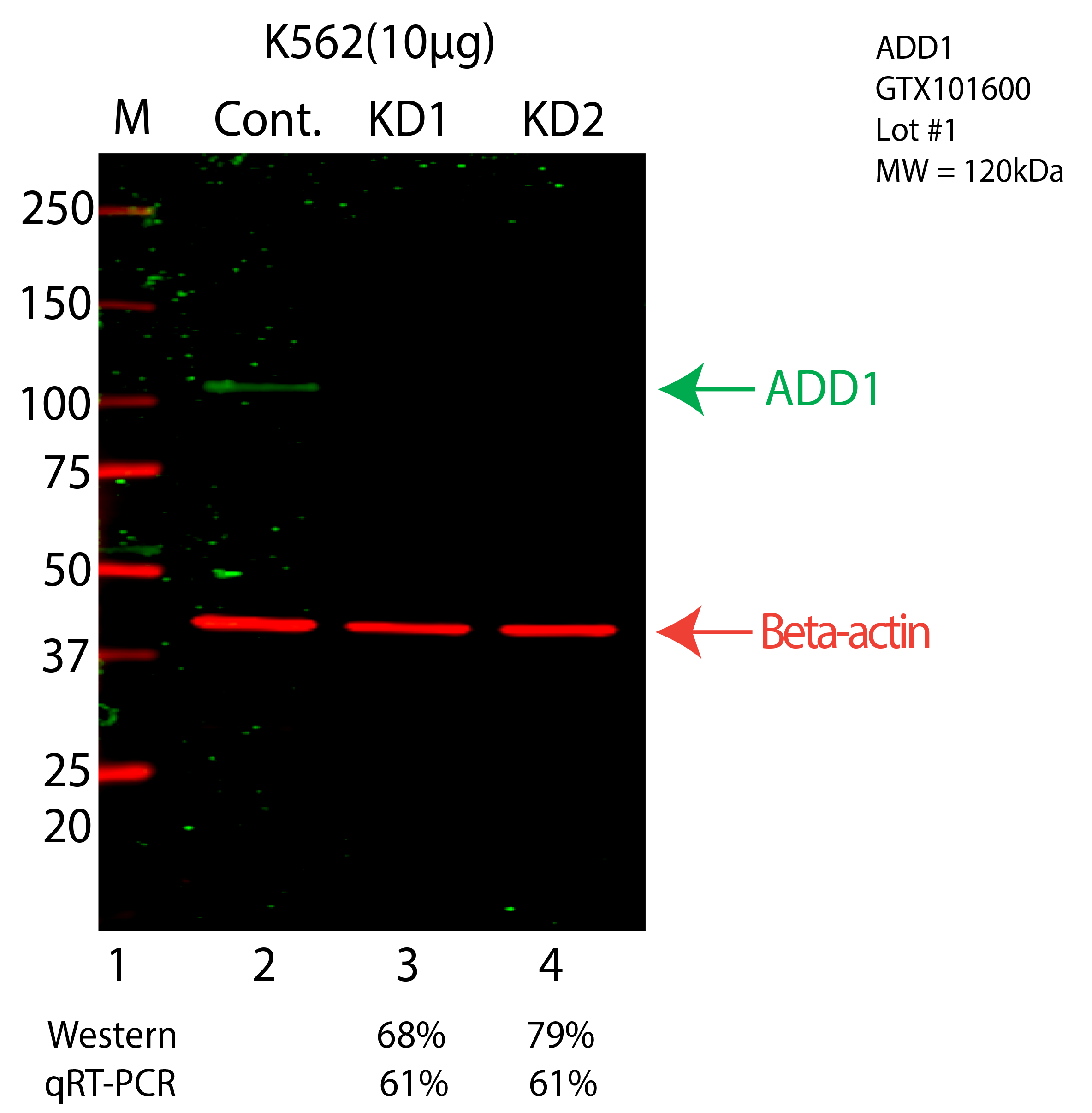 ADD1-K562-CRISPR-GTX101600.png<br>Caption: Western blot following CRISPR against ADD1 in K562 whole cell lysate using ADD1 specific antibody. Lane 1 is a ladder, lane 2 is K562 non-targeting control knockdown, lane 3 and 4 are two different CRISPR against ADD1. ADD1 protein appears as the green arrow, Beta-actin serves as a control and appears in red arrow.