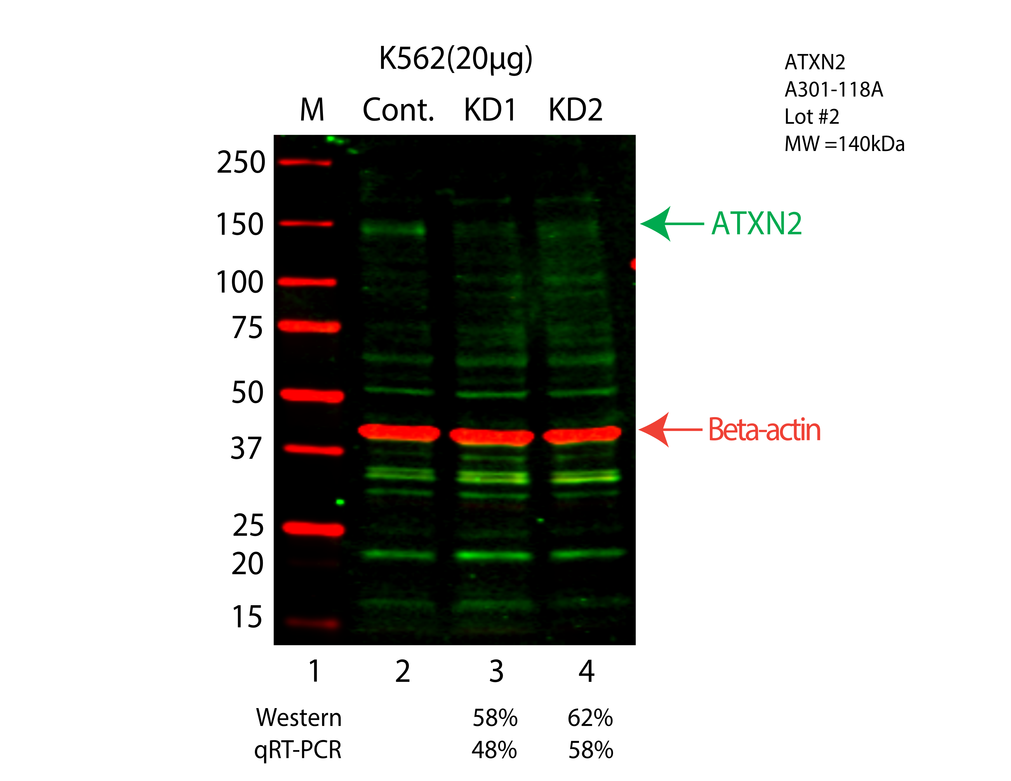 ATXN2-K562-CRISPR-A301-118A.png<br>Caption: Western blot following CRISPR against ATXN2 in K562 whole cell lysate using ATXN2 specific antibody. Lane 1 is a ladder, lane 2 is K562 non-targeting control knockdown, lane 3 and 4 are two different CRISPR against ATXN2. ATXN2 protein appears as the green arrow, Beta-actin serves as a control and appears in red arrow.
