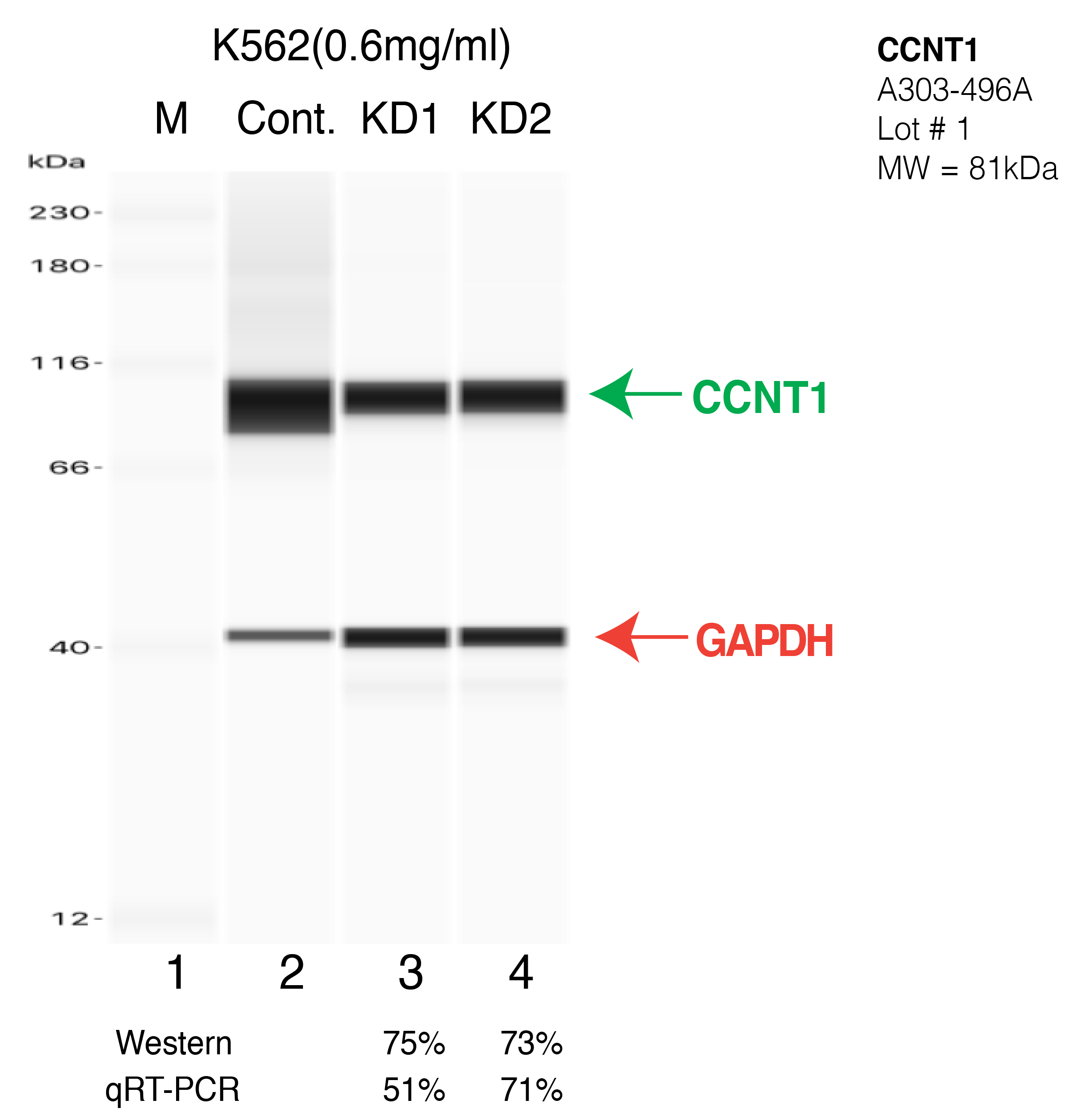 CCNT1-K562-CRISPR-A303-496A.png<br>Caption: Western blot following CRISPR against CCNT1 in K562 whole cell lysate using CCNT1 specific antibody. Lane 1 is a ladder, lane 2 is K562 non-targeting control knockdown, lane 3 and 4 are two different CRISPR against CCNT1. CCNT1 protein appears as the green arrow, GAPDH serves as a control and appears in red arrow.