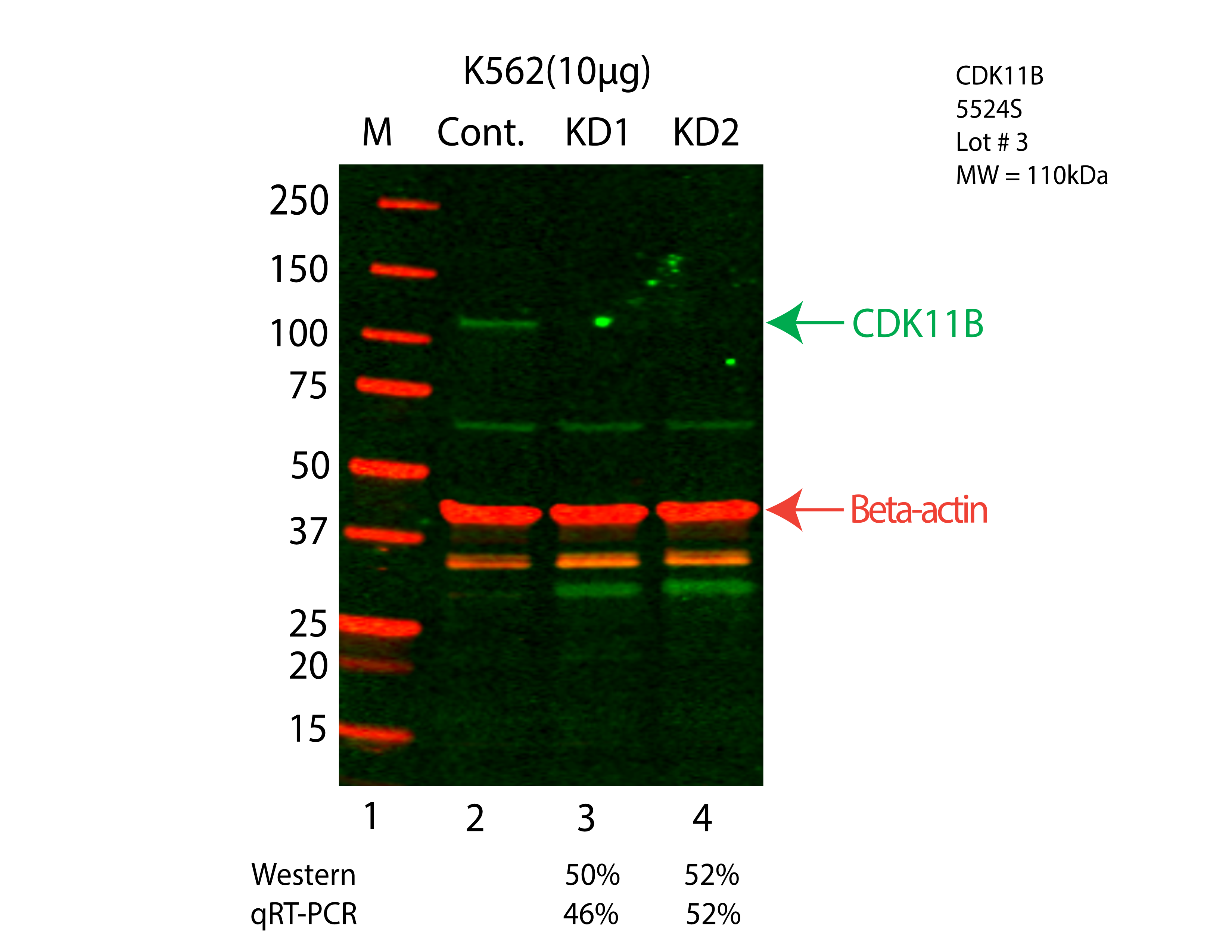 CDK11B-K562-CRISPR-5524S.png<br>Caption: Western blot following CRISPR against CDK11B in K562 whole cell lysate using CDK11B specific antibody. Lane 1 is a ladder, lane 2 is K562 non-targeting control knockdown, lane 3 and 4 are two different CRISPR against CDK11B. CDK11B protein appears as the green arrow, Beta-actin serves as a control and appears in red arrow.