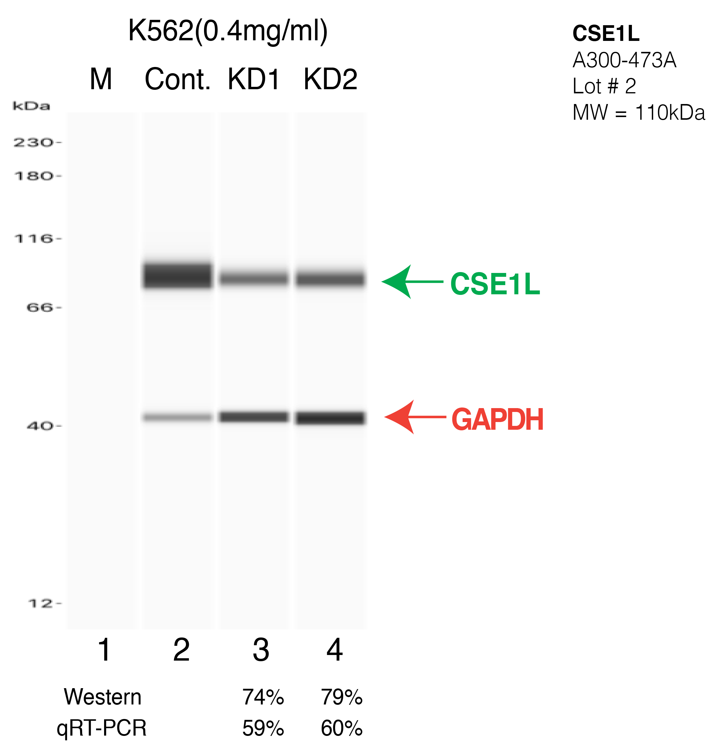 CSE1L-K562-CRISPR-A300-473A.png<br>Caption: Western blot following CRISPR against CSE1L in K562 whole cell lysate using CSE1L specific antibody. Lane 1 is a ladder, lane 2 is K562 non-targeting control knockdown, lane 3 and 4 are two different CRISPR against CSE1L. CSE1L protein appears as the green arrow, GAPDH serves as a control and appears in red arrow.