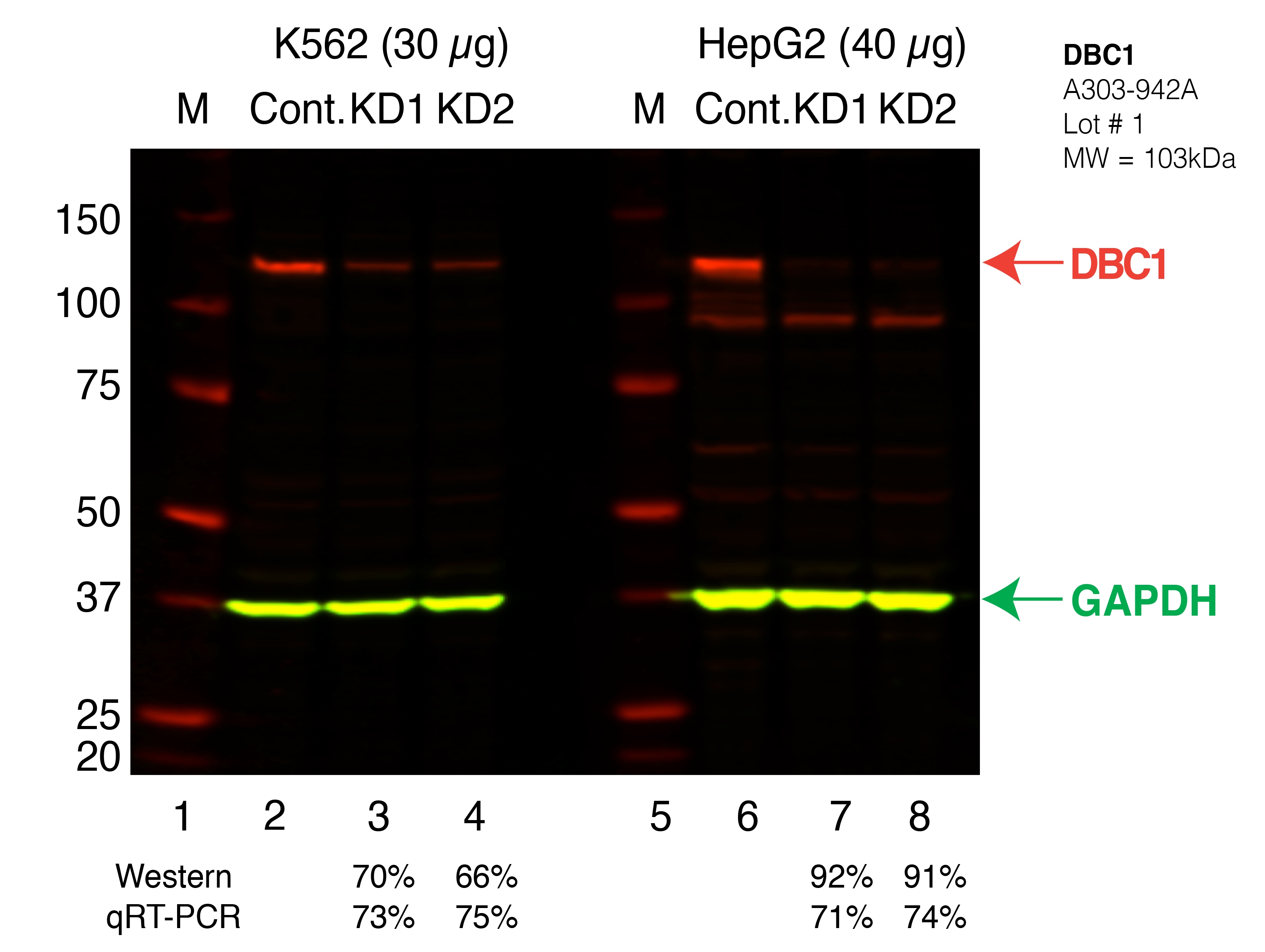 DBC1_Secondary_Western.png<br>Caption: Western blot following shRNA against DBC1 in K562 and HepG2 whole cell lysate using DBC1 specific antibody. Lane 1 is a ladder, lane 2 is K562 non-targeting control knockdown, lane 3 and 4 are two different shRNAs against DBC1. Lanes 5-8 follow the same pattern, but in HepG2. DBC1 protein appears as the red band, GAPDH serves as a control and appears in green.