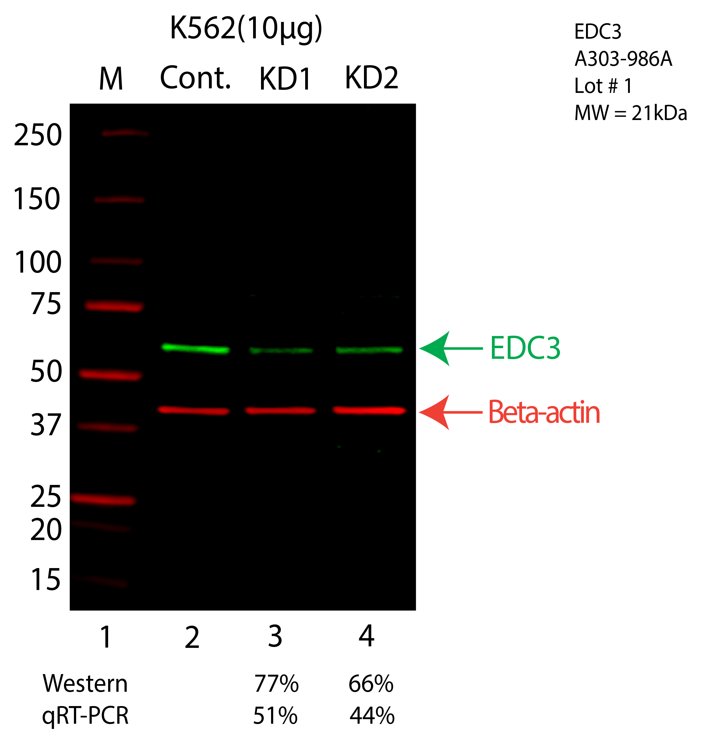 EDC3-K562-CRISPR-A303-986A.png<br>Caption: Western blot following CRISPR against EDC3 in K562 whole cell lysate using EDC3 specific antibody. Lane 1 is a ladder, lane 2 is K562 non-targeting control knockdown, lane 3 and 4 are two different CRISPR against EDC3. EDC3 protein appears as the green arrow, Beta-actin serves as a control and appears in red arrow.