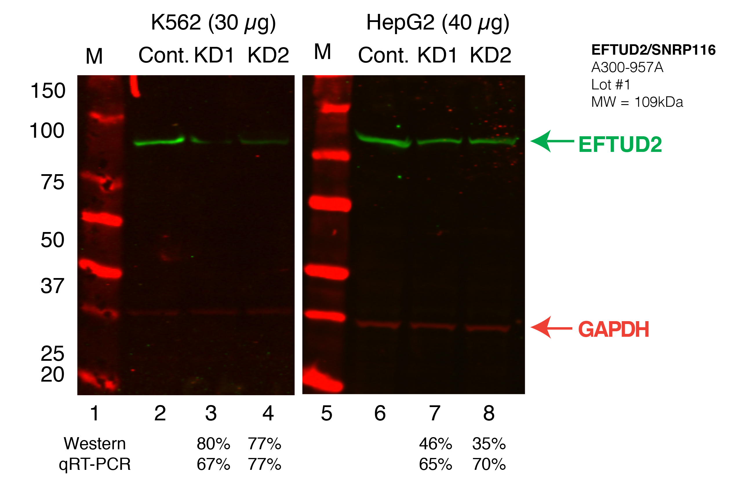 EFTUD2_Secondary_Western.png<br>Caption: Western blot following shRNA against EFTUD2 in K562 and HepG2 whole cell lysate using EFTUD2 specific antibody. Lane 1 is a ladder, lane 2 is K562 non-targeting control knockdown, lane 2 and 3 are two different shRNAs against EFTUD2. Lanes 5-7 follow the same pattern, but in HepG2. EFTUD2 protein appears as the green band, GAPDH serves as a control and appears in red.