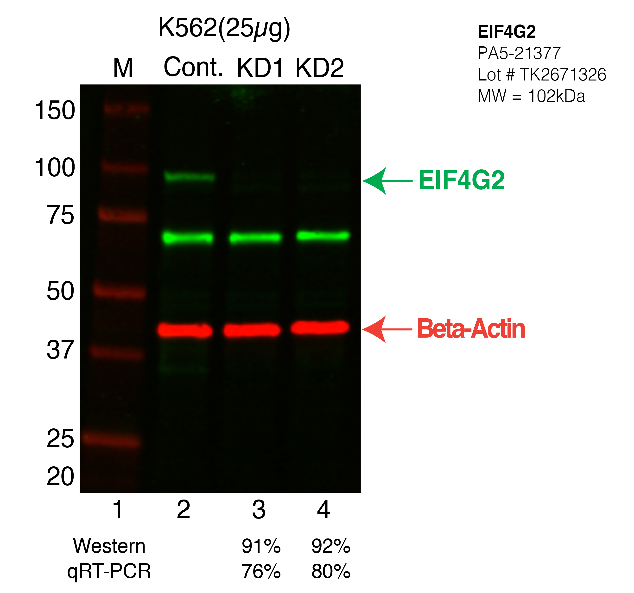 EIF4G2-K562-PA5-21377.png<br>Caption: Western blot following shRNA against EIF4G2 in K562 whole cell lysate using EIF4G2 specific antibody. Lane 1 is a ladder, lane 2 is K562 non-targeting control knockdown, lane 3 and 4 are two different shRNA against EIF4G2. EIF4G2 protein appears as the green arrow, Beta-actin serves as a control and appears in red arrow.