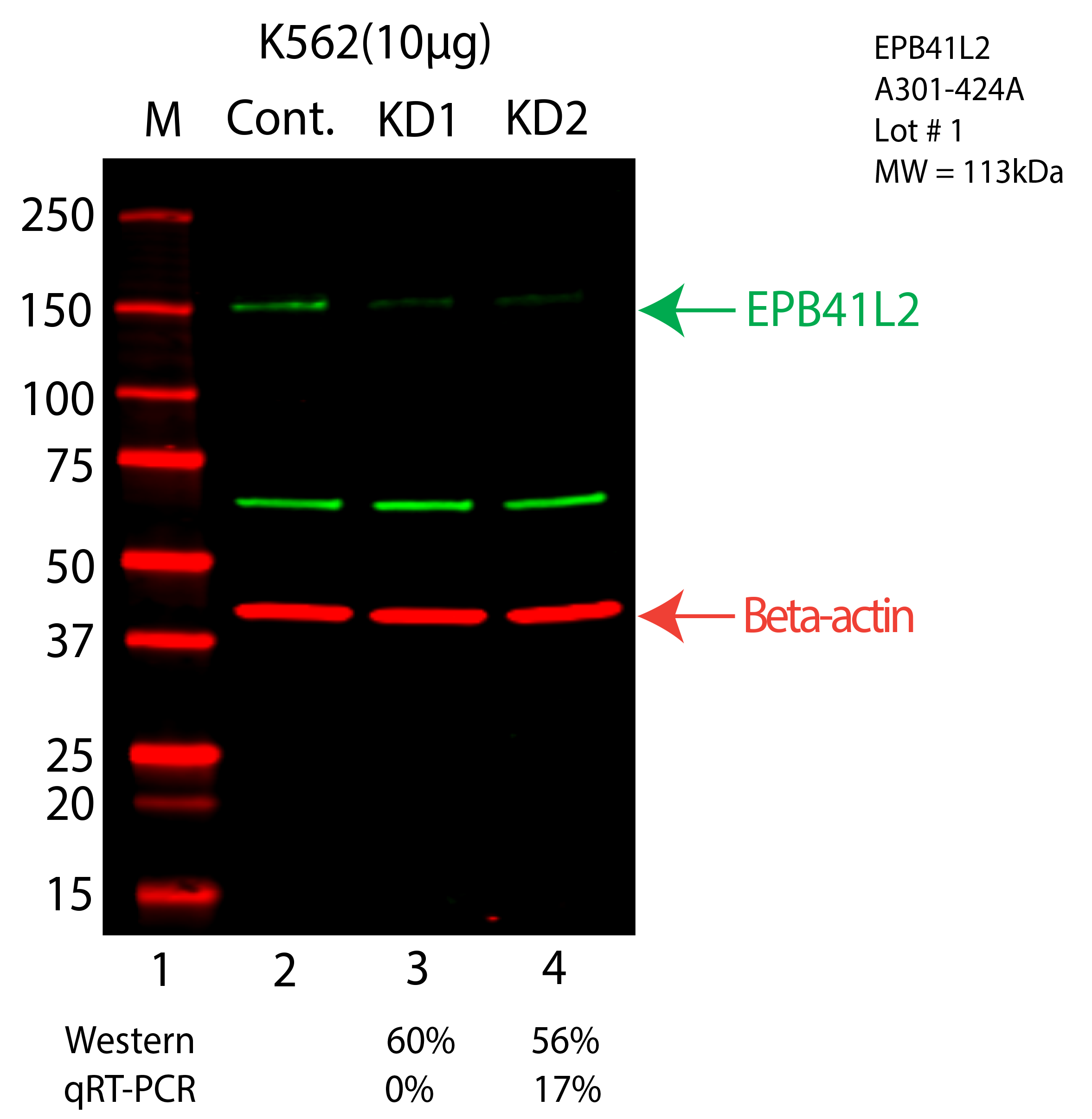 EPB41L2-K562-CRISPR-A301-424A.png<br>Caption: Western blot following CRISPR against EPB41L2 in K562 whole cell lysate using EPB41L2 specific antibody. Lane 1 is a ladder, lane 2 is K562 non-targeting control knockdown, lane 3 and 4 are two different CRISPR against EPB41L2. EPB41L2 protein appears as the green arrow, Beta-actin serves as a control and appears in red arrow.