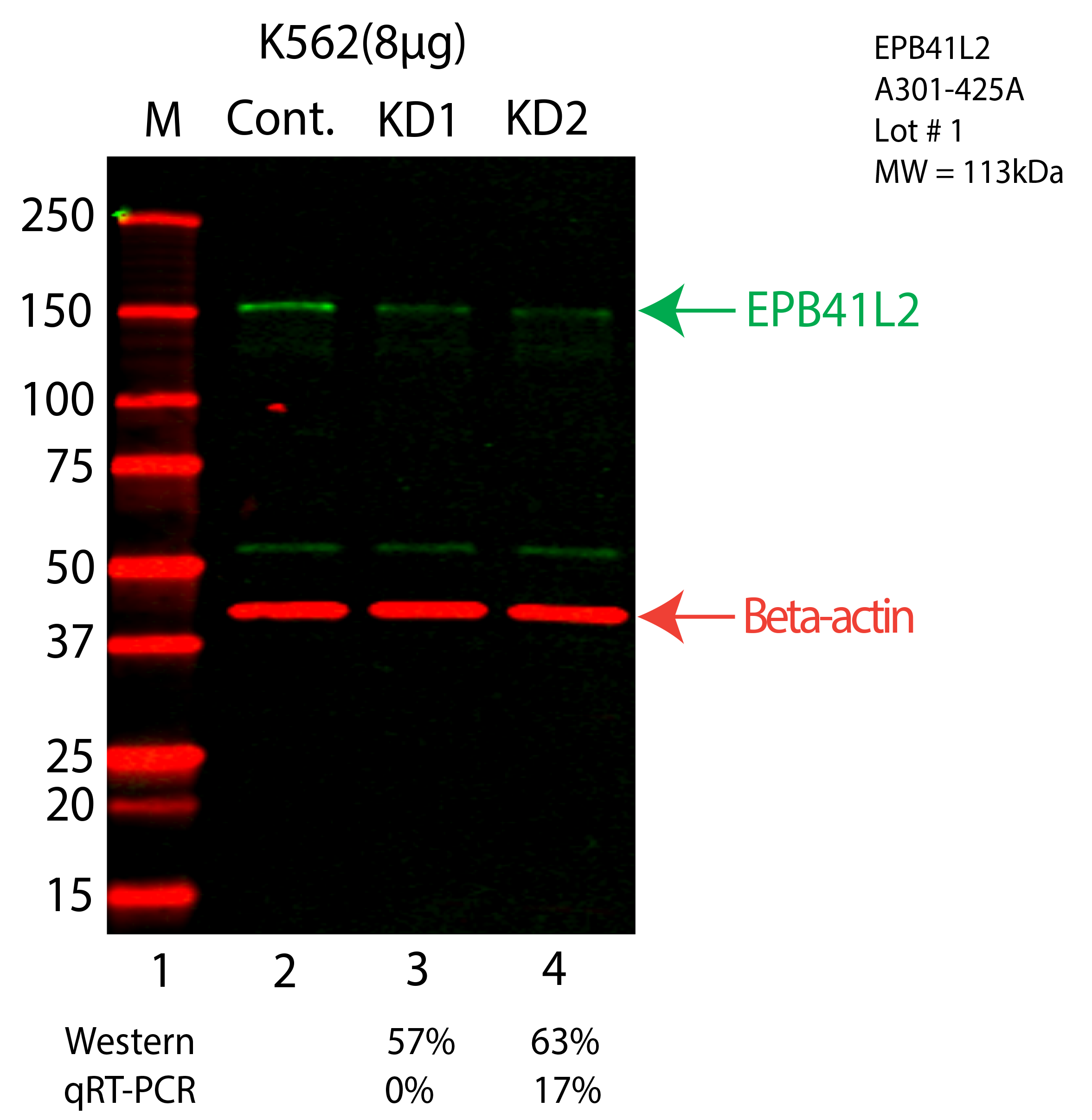 EPB41L2-K562-CRISPR-A301-425A.png<br>Caption: Western blot following CRISPR against EPB41L2 in K562 whole cell lysate using EPB41L2 specific antibody. Lane 1 is a ladder, lane 2 is K562 non-targeting control knockdown, lane 3 and 4 are two different CRISPR against EPB41L2. EPB41L2 protein appears as the green arrow, Beta-actin serves as a control and appears in red arrow.