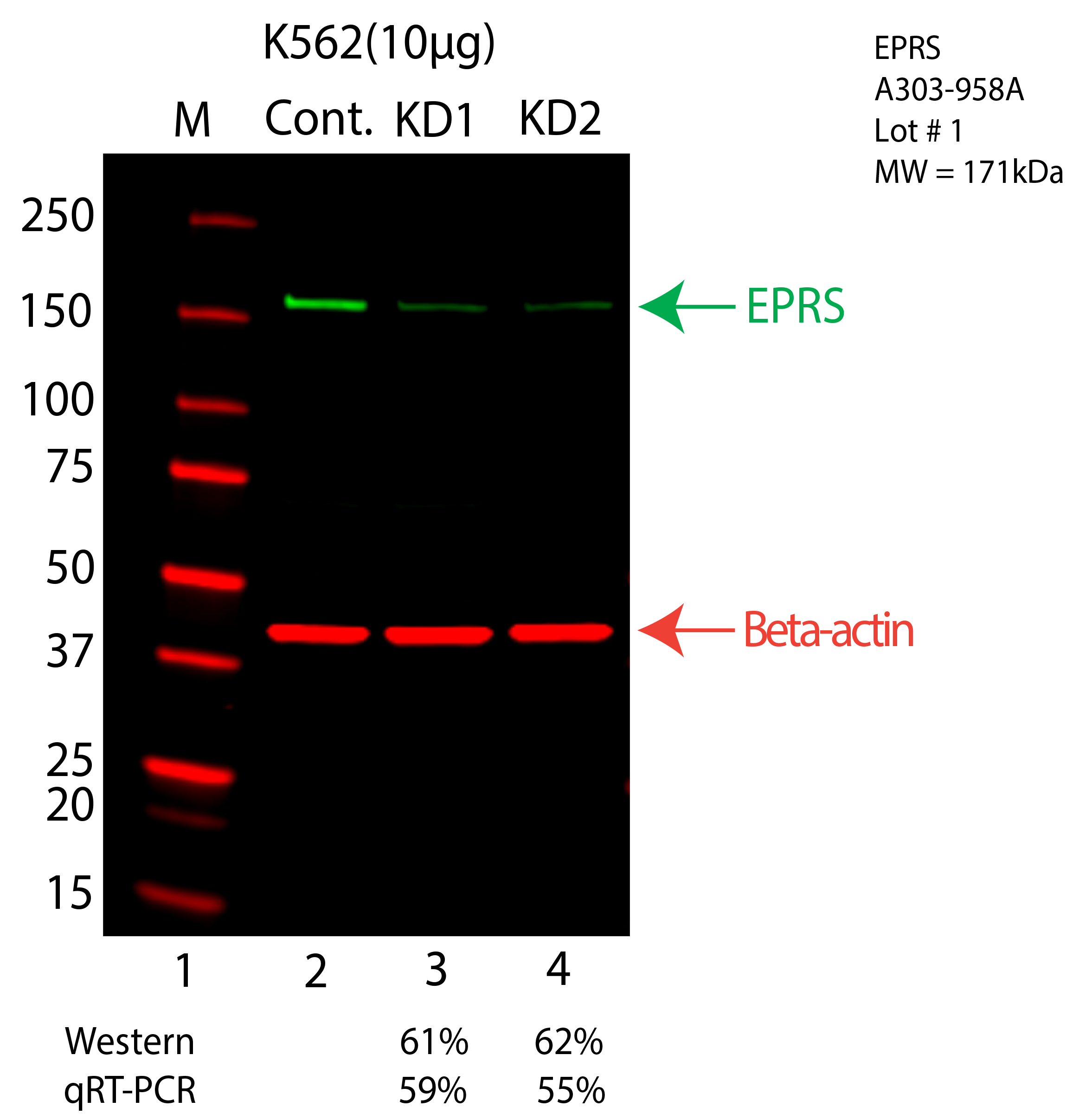 EPRS-K562-CRISPR-A303-958A.png<br>Caption: Western blot following CRISPR against EPRS in K562 whole cell lysate using EPRS specific antibody. Lane 1 is a ladder, lane 2 is K562 non-targeting control knockdown, lane 3 and 4 are two different CRISPR against EPRS. EPRS protein appears as the green arrow, Beta-actin serves as a control and appears in red arrow.