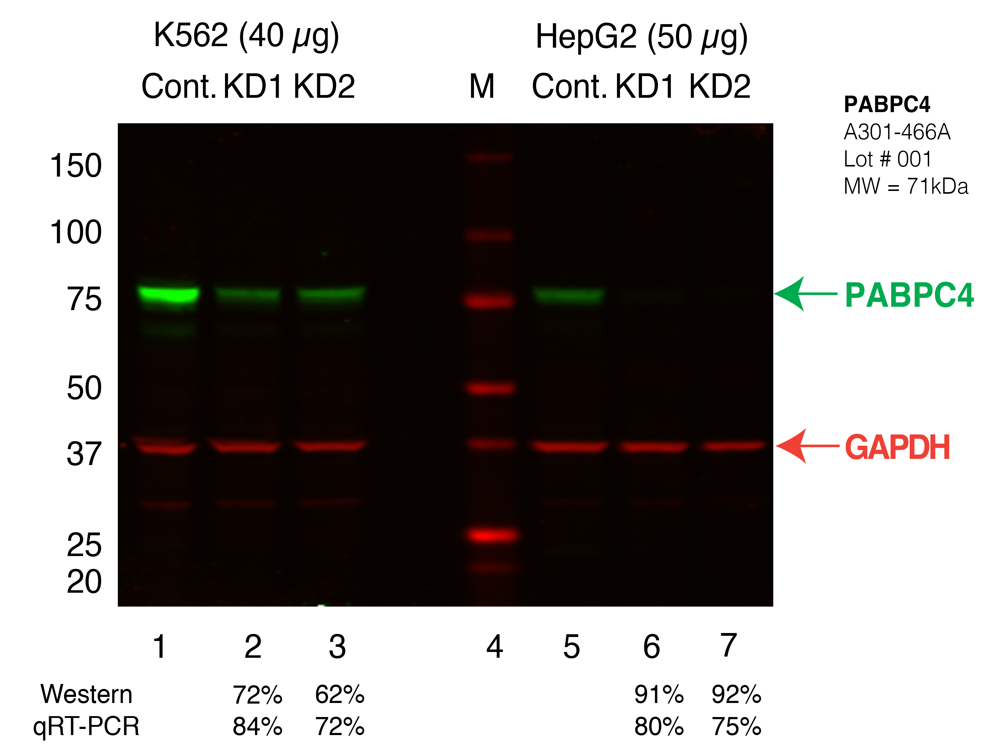 PABPC4_Secondary_Western.png<br>Caption: Western blot following shRNA against PABPC4 in K562 and HepG2 whole cell lysate using PABPC4 specific antibody. Lane 4 is a ladder, lane 1 is K562 non-targeting control knockdown, lane 2 and 3 are two different shRNAs against PABPC4. Lanes 5-7 follow the same pattern, but in HepG2. PABPC4 protein appears as the green band, GAPDH serves as a control and appears in red.