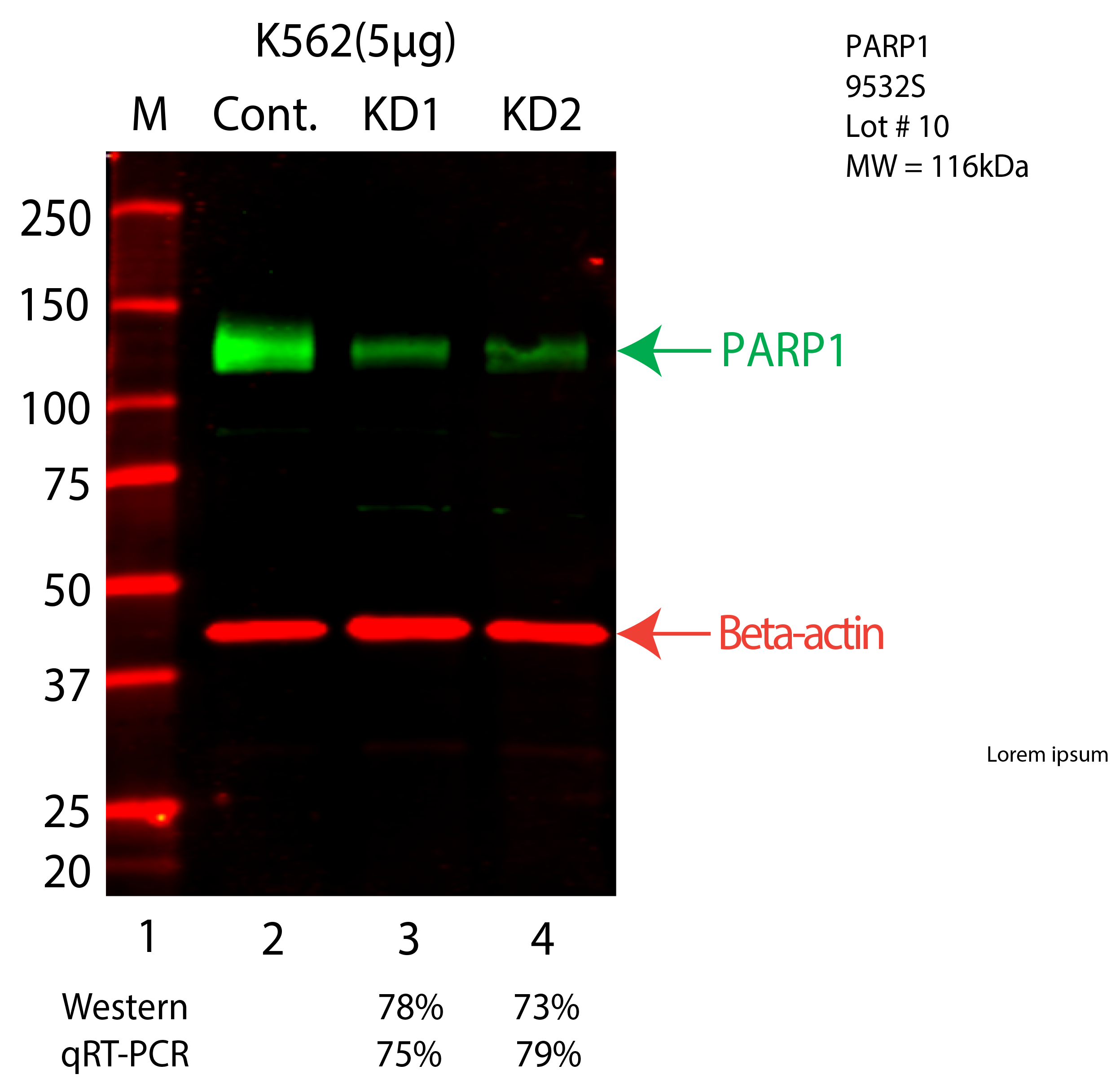 PARP1-K562-CRISPR-9532S.png<br>Caption: Western blot following CRISPR against PARP1 in K562 whole cell lysate using PARP1 specific antibody. Lane 1 is a ladder, lane 2 is K562 non-targeting control knockdown, lane 3 and 4 are two different CRISPR against PARP1. PARP1 protein appears as the green arrow, Beta-actin serves as a control and appears in red arrow.