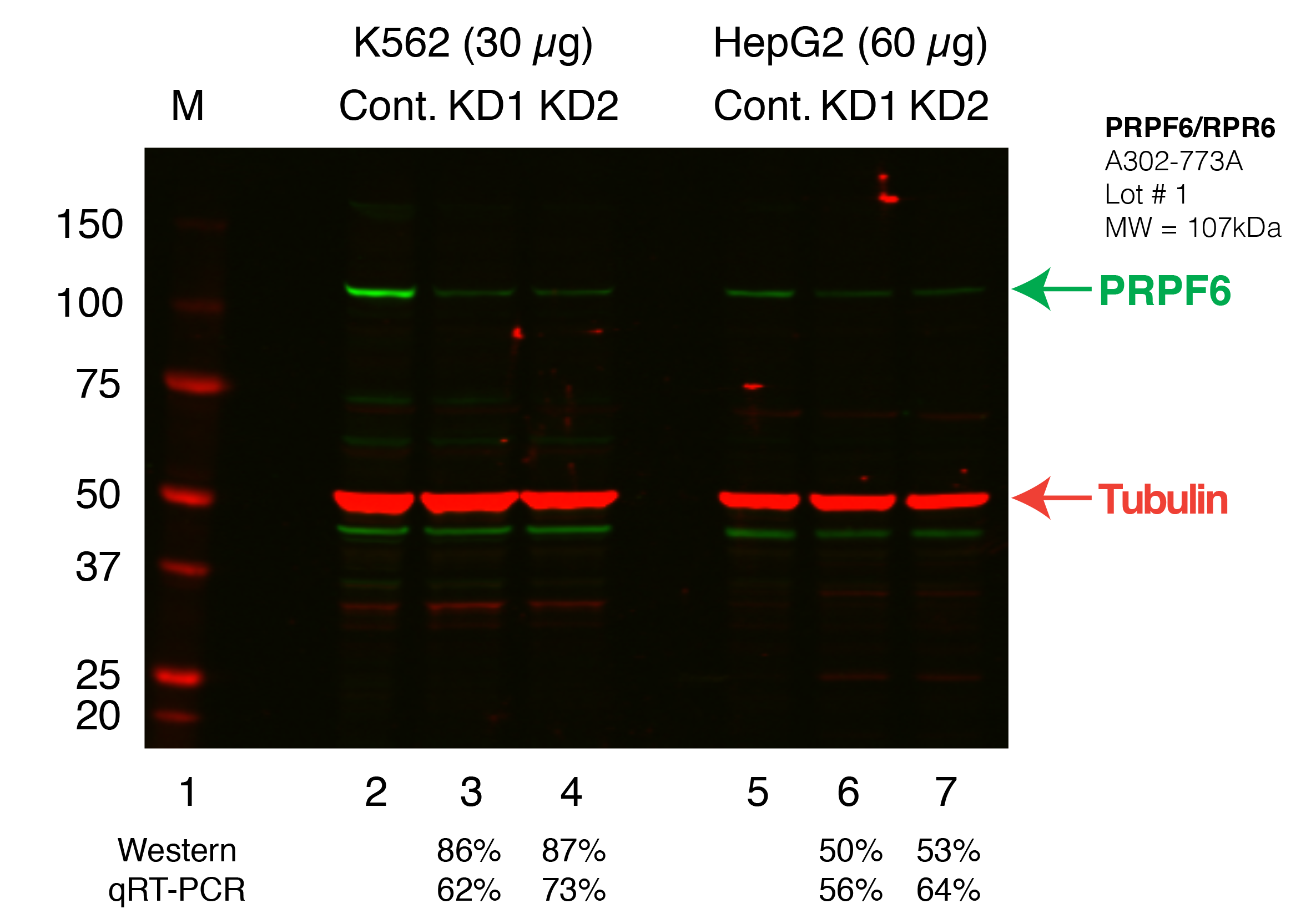 PRPF6_Secondary_Western.png<br>Caption: Western blot following shRNA against PRPF6 in K562 and HepG2 whole cell lysate using PRPF6 specific antibody. Lane 1 is a ladder, lane 2 is K562 non-targeting control knockdown, lane 2 and 3 are two different shRNAs against PRPF6. Lanes 5-7 follow the same pattern, but in HepG2. PRPF6 protein appears as the green band, GAPDH serves as a control and appears in red.