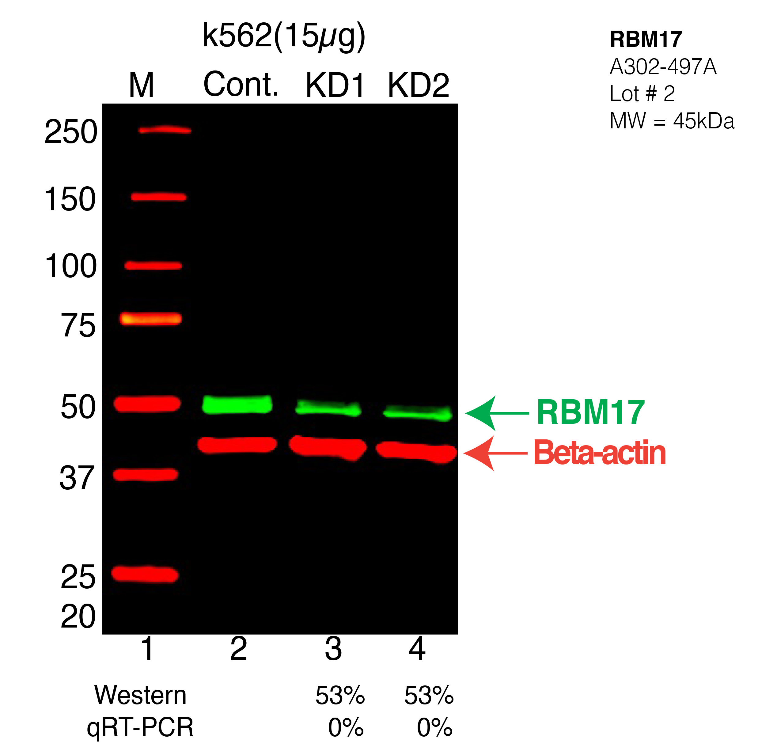 RBM17-K562-CRISPR-A302-497A.png<br>Caption: Western blot following CRISPR against RBM17 in K562 whole cell lysate using RBM17 specific antibody. Lane 1 is a ladder, lane 2 is K562 non-targeting control knockdown, lane 3 and 4 are two different CRISPR against RBM17. RBM17 protein appears as the green arrow, Beta-actin serves as a control and appears in red arrow.