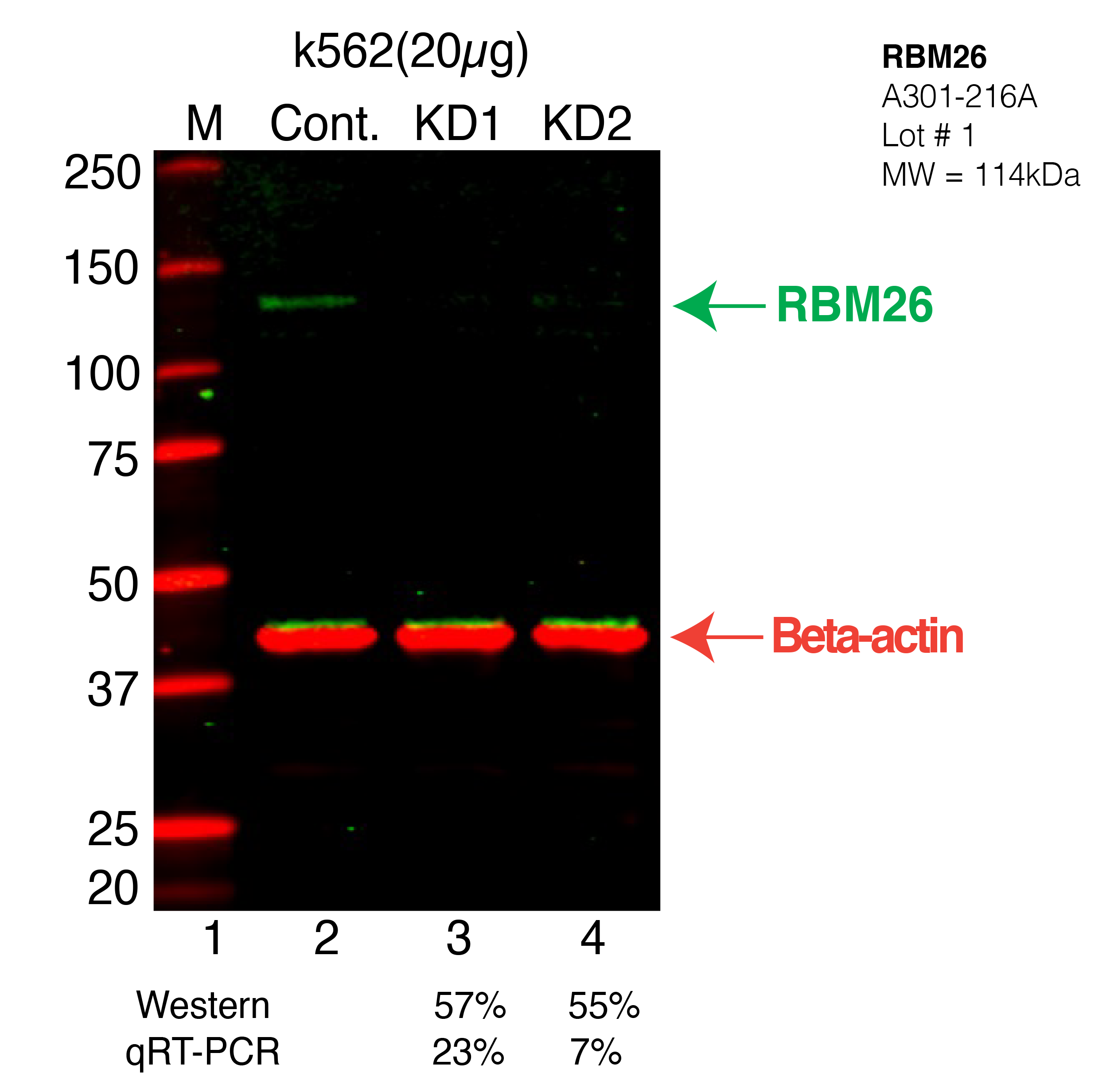 RBM26-K562-CRISPR-A301-216A.png<br>Caption: Western blot following CRISPR against RBM26 in K562 whole cell lysate using RBM26 specific antibody. Lane 1 is a ladder, lane 2 is K562 non-targeting control knockdown, lane 3 and 4 are two different CRISPR against RBM26. RBM26 protein appears as the green arrow, Beta-actin serves as a control and appears in red arrow.