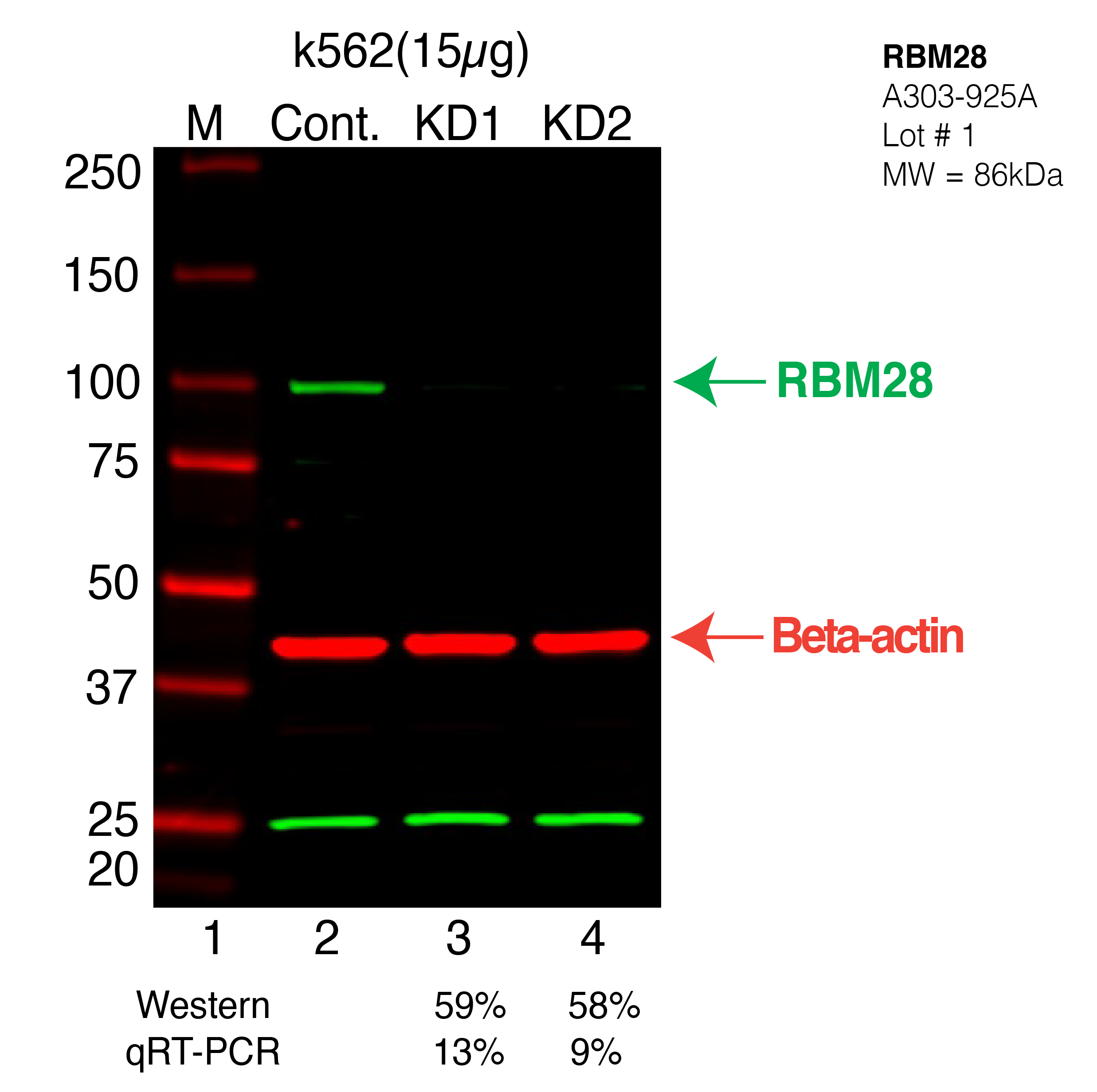 RBM28-K562-CRISPR-A303-925A.png<br>Caption: Western blot following CRISPR against RBM28 in K562 whole cell lysate using RBM28 specific antibody. Lane 1 is a ladder, lane 2 is K562 non-targeting control knockdown, lane 3 and 4 are two different CRISPR against RBM28. RBM28 protein appears as the green arrow, Beta-actin serves as a control and appears in red arrow.