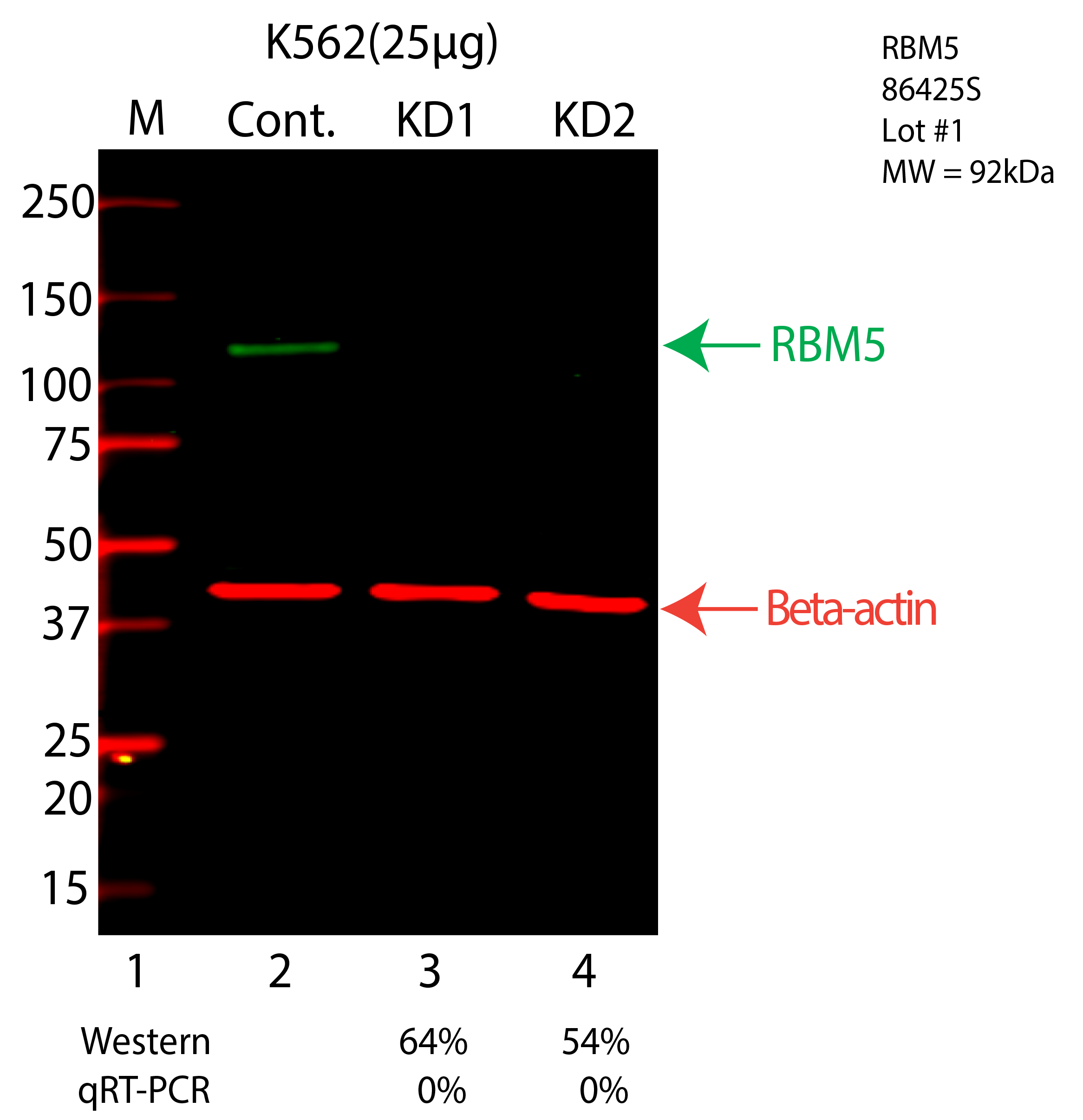 RBM5-K562-CRISPR-86425S.png<br>Caption: Western blot following CRISPR against RBM5 in K562 whole cell lysate using RBM5 specific antibody. Lane 1 is a ladder, lane 2 is K562 non-targeting control knockdown, lane 3 and 4 are two different CRISPR against RBM5. RBM5 protein appears as the green arrow, Beta-actin serves as a control and appears in red arrow.