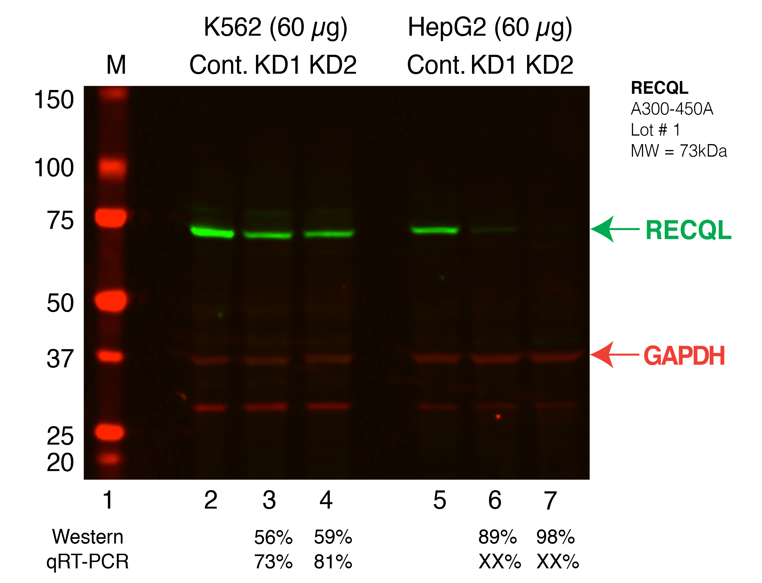 RECQL_Secondary_Western.png<br>Caption: Western blot following shRNA against RECQL in K562 and HepG2 whole cell lysate using RECQL specific antibody. Lane 1 is a ladder, lane 2 is K562 non-targeting control knockdown, lane 3 and 4 are two different shRNAs against RECQL. Lanes 5-7 follow the same pattern, but in HepG2. RECQL protein appears as the green band, GAPDH serves as a control and appears in red.