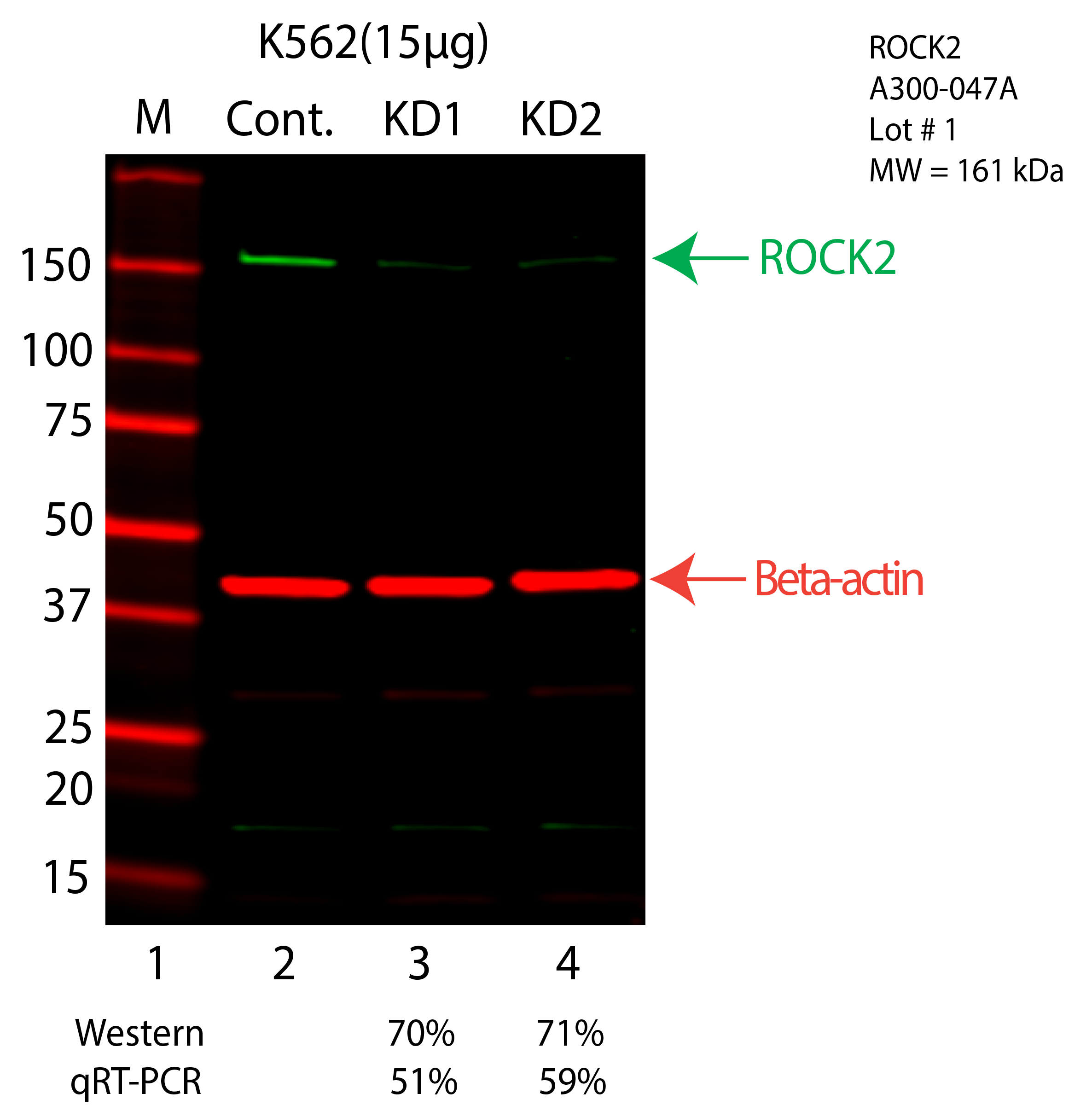 ROCK2-K562-CRISPR-A300-047A.png<br>Caption: Western blot following CRISPR against ROCK2 in K562 whole cell lysate using ROCK2 specific antibody. Lane 1 is a ladder, lane 2 is K562 non-targeting control knockdown, lane 3 and 4 are two different CRISPR against ROCK2. ROCK2 protein appears as the green arrow, Beta-actin serves as a control and appears in red arrow.