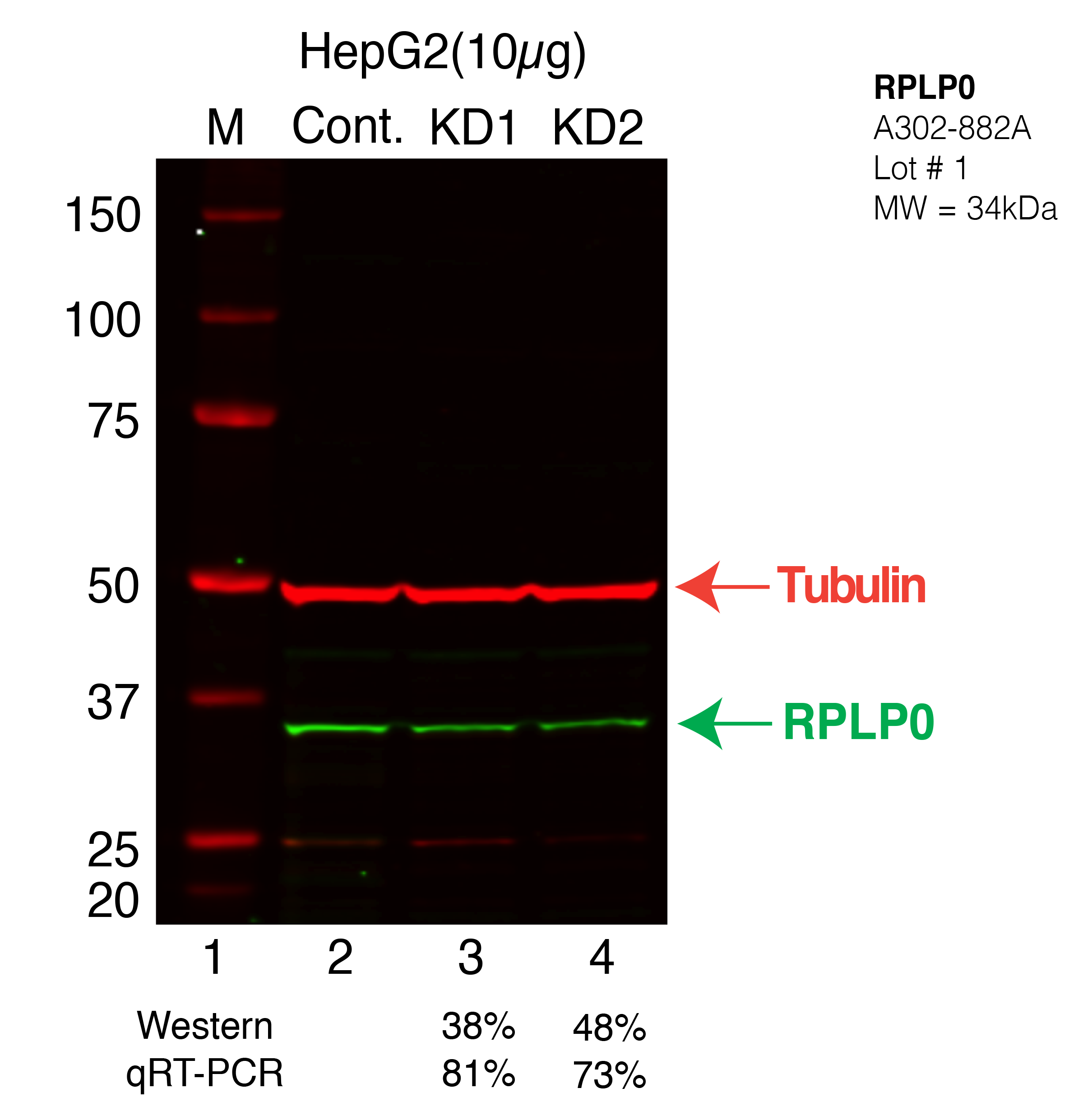 RPLP0-HEPG2.png<br>Caption: Western blot following shRNA against RPLP0 in HepG2 whole cell lysate using RPLP0 specific antibody. Lane 1 is a ladder, lane 2 is HepG2 non-targeting control knockdown, lane 3 and 4 are two different shRNAs against RPLP0.RPLP0 protein appears as the green arrow, Tubulin serves as a control and appears in red arrow.