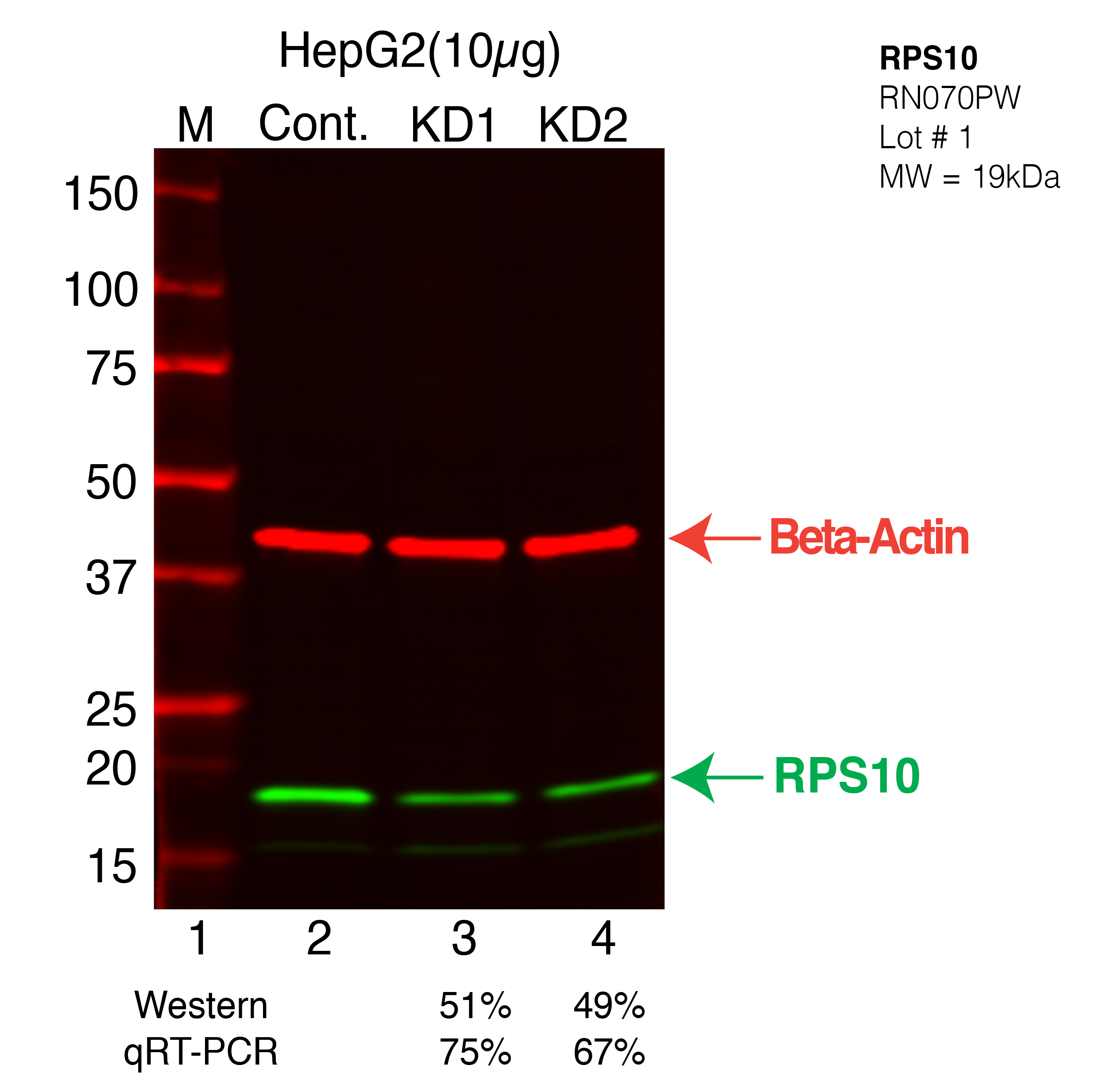 RPS10-HEPG2-RN070PW.png<br>Caption: Western blot following shRNA against RPS10 in HepG2 whole cell lysate using RPS10 specific antibody. Lane 1 is a ladder, lane 2 is HepG2 non-targeting control knockdown, lane 3 and 4 are two different shRNA against RPS10. RPS10 protein appears as the green arrow, Beta-actin serves as a control and appears in red arrow.