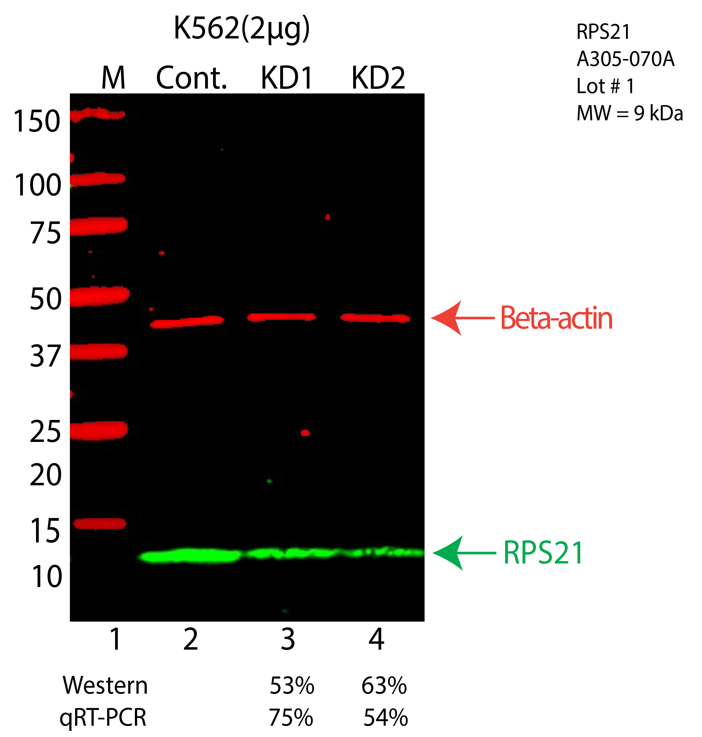 RPS21-K562-CRISPR-A305-070A.png<br>Caption: Western blot following CRISPR against RPS21 in K562 whole cell lysate using RPS21 specific antibody. Lane 1 is a ladder, lane 2 is K562 non-targeting control knockdown, lane 3 and 4 are two different CRISPR against RPS21. RPS21 protein appears as the green arrow, Beta-actin serves as a control and appears in red arrow.