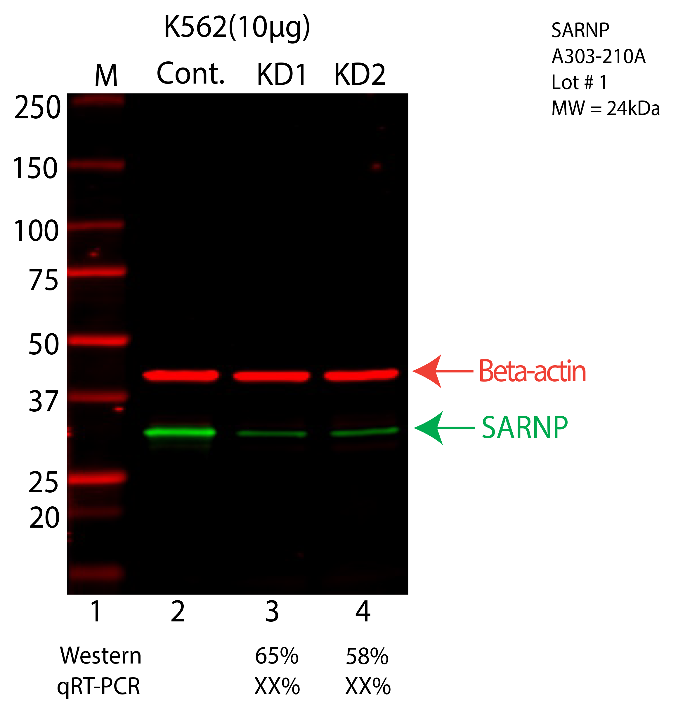 SARNP-K562-CRISPR-A303-210A.png<br>Caption: Western blot following CRISPR against SARNP in K562 whole cell lysate using SARNP specific antibody. Lane 1 is a ladder, lane 2 is K562 non-targeting control knockdown, lane 3 and 4 are two different CRISPR against SARNP. SARNP protein appears as the green arrow, Beta-actin serves as a control and appears in red arrow.