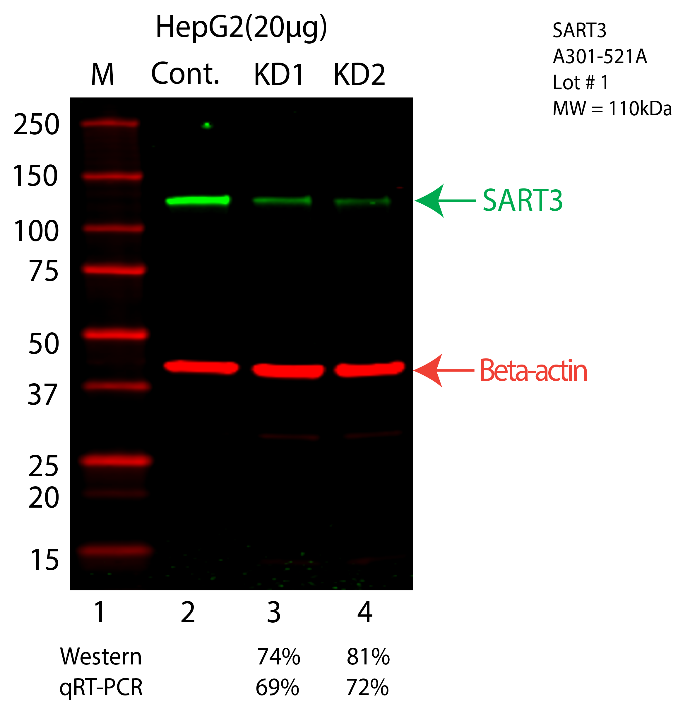 SART3-HEPG2-A301-521A.png<br>Caption: Western blot following shRNA against SART3 in HepG2 whole cell lysate using SART3 specific antibody. Lane 1 is a ladder, lane 2 is HepG2 non-targeting control knockdown, lane 3 and 4 are two different shRNA against SART3. SART3 protein appears as the green arrow, Beta-actin serves as a control and appears in red arrow.