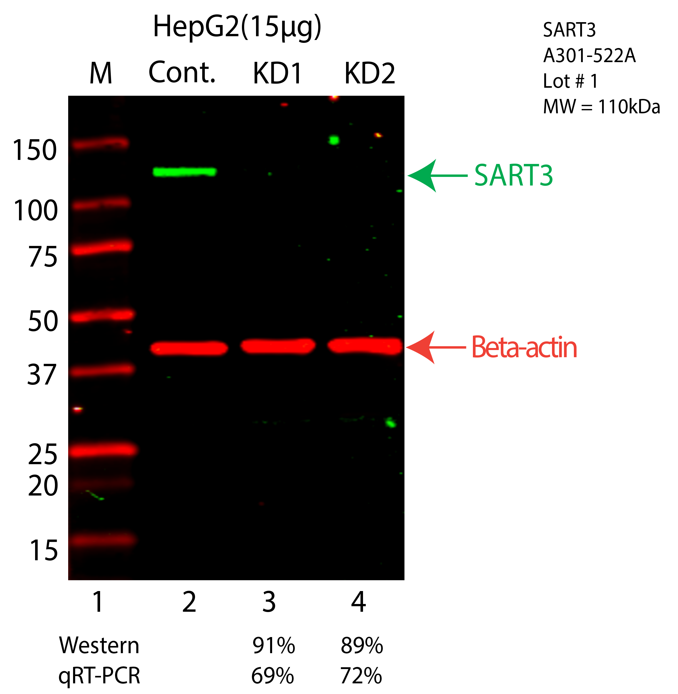 SART3-HEPG2-A301-522A.png<br>Caption: Western blot following shRNA against SART3 in HepG2 whole cell lysate using SART3 specific antibody. Lane 1 is a ladder, lane 2 is HepG2 non-targeting control knockdown, lane 3 and 4 are two different shRNA against SART3. SART3 protein appears as the green arrow, Beta-actin serves as a control and appears in red arrow.