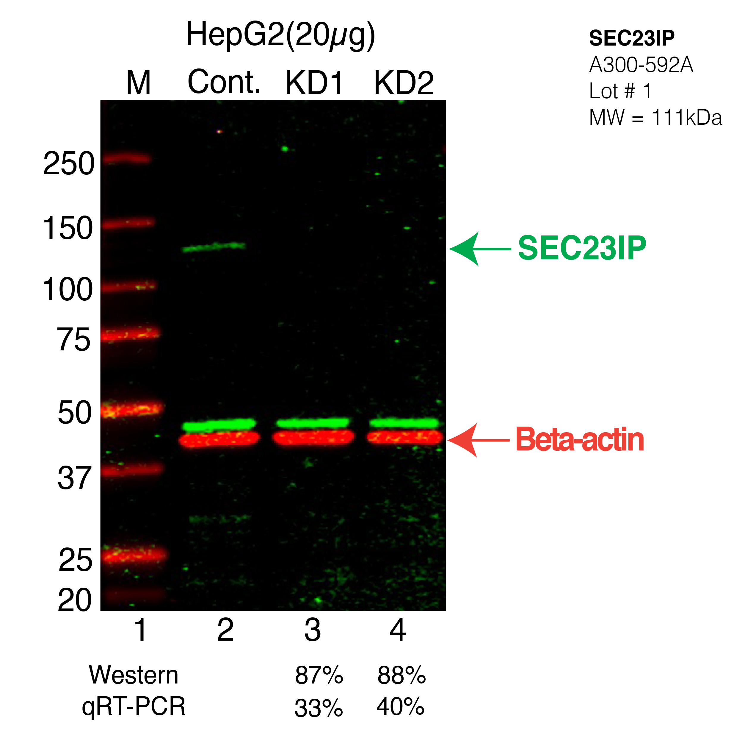 SEC23IP-HEPG2-CRISPR-A300-592A.png<br>Caption: Western blot following CRISPR against SEC23IP in HepG2 whole cell lysate using SEC23IP specific antibody. Lane 1 is a ladder, lane 2 is HepG2 non-targeting control knockdown, lane 3 and 4 are two different CRISPR against SEC23IP. SEC23IP protein appears as the green arrow, Beta-actin serves as a control and appears in red arrow.