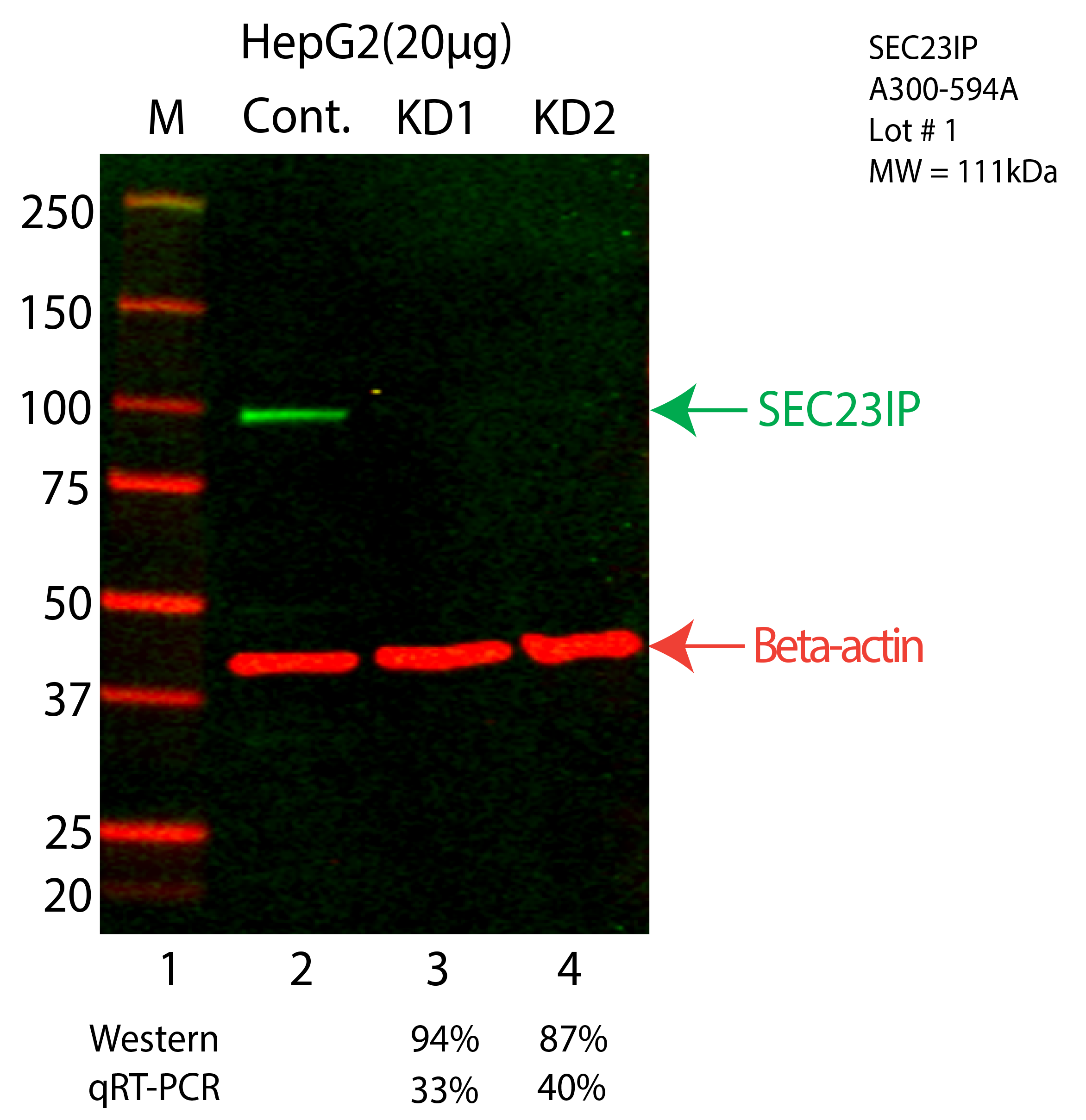 SEC23IP-HEPG2-CRISPR-A300-594A.png<br>Caption: Western blot following CRISPR against SEC23IP in HepG2 whole cell lysate using SEC23IP specific antibody. Lane 1 is a ladder, lane 2 is HepG2 non-targeting control knockdown, lane 3 and 4 are two different CRISPR against SEC23IP. SEC23IP protein appears as the green arrow, Beta-actin serves as a control and appears in red arrow.