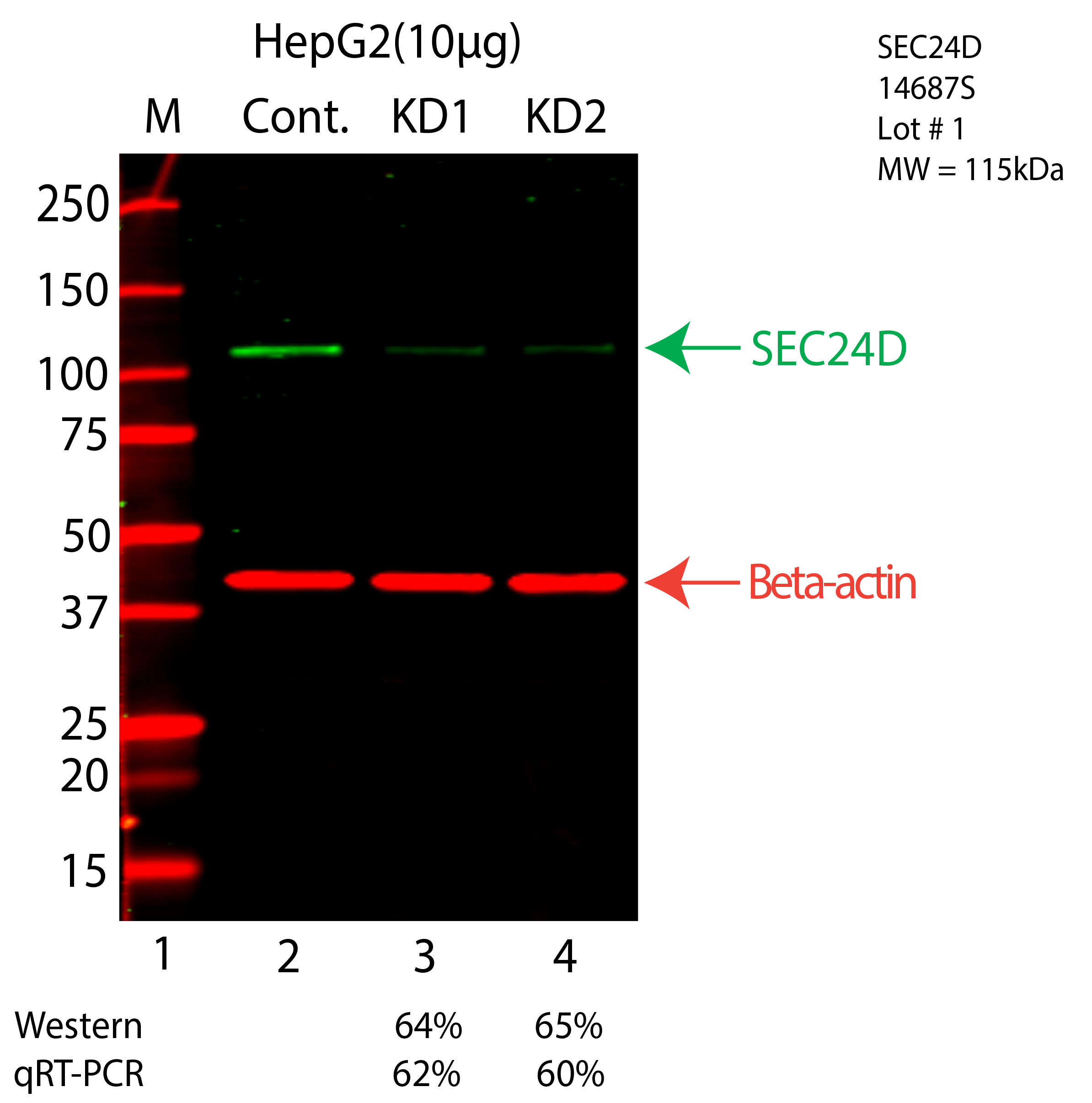 SEC24D-HEPG2-CRISPR-14687S.png<br>Caption: Western blot following CRISPR against SEC24D in HepG2 whole cell lysate using SEC24D specific antibody. Lane 1 is a ladder, lane 2 is HepG2 non-targeting control knockdown, lane 3 and 4 are two different CRISPR against SEC24D. SEC24D protein appears as the green arrow, Beta-actin serves as a control and appears in red arrow.