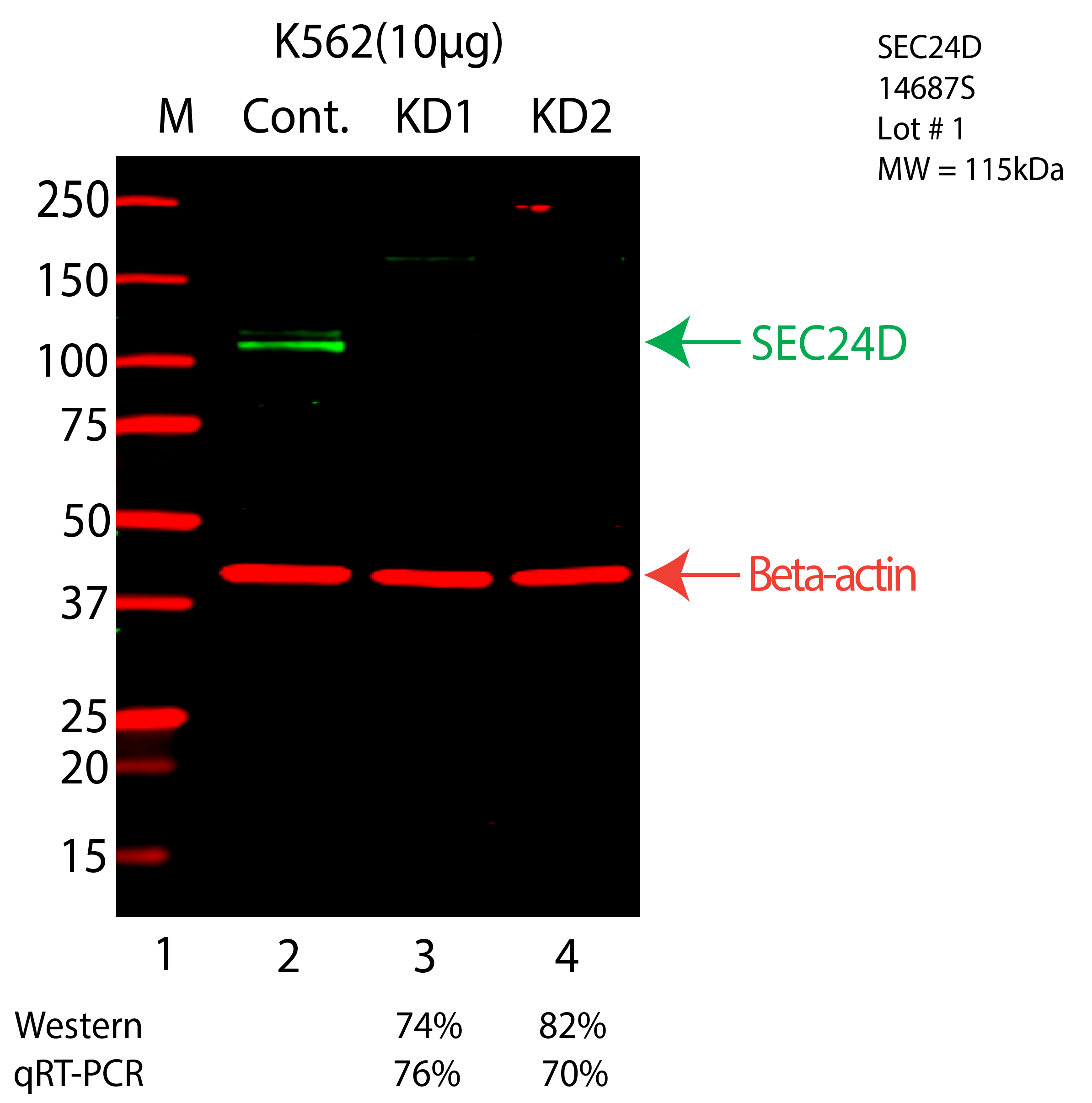 SEC24D-K562-CRISPR-14687S.png<br>Caption: Western blot following CRISPR against SEC24D in K562 whole cell lysate using SEC24D specific antibody. Lane 1 is a ladder, lane 2 is K562 non-targeting control knockdown, lane 3 and 4 are two different CRISPR against SEC24D. SEC24D protein appears as the green arrow, Beta-actin serves as a control and appears in red arrow.