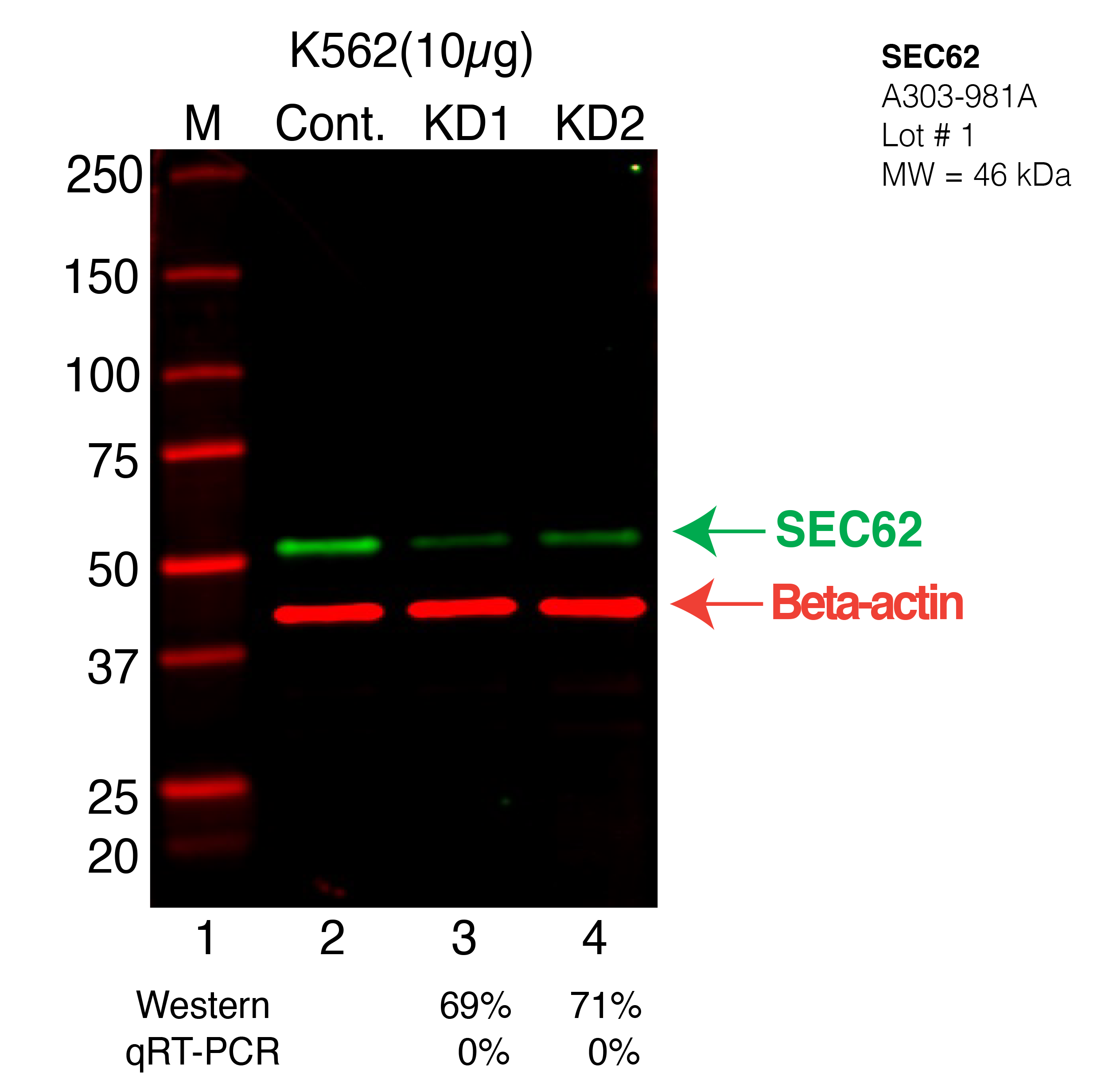 SEC62-K562-CRISPR-A303-981A.png<br>Caption: Western blot following CRISPR against SEC62 in K562 whole cell lysate using SEC62 specific antibody. Lane 1 is a ladder, lane 2 is K562 non-targeting control knockdown, lane 3 and 4 are two different CRISPR against SEC62. SEC62 protein appears as the green arrow, Beta-actin serves as a control and appears in red arrow.