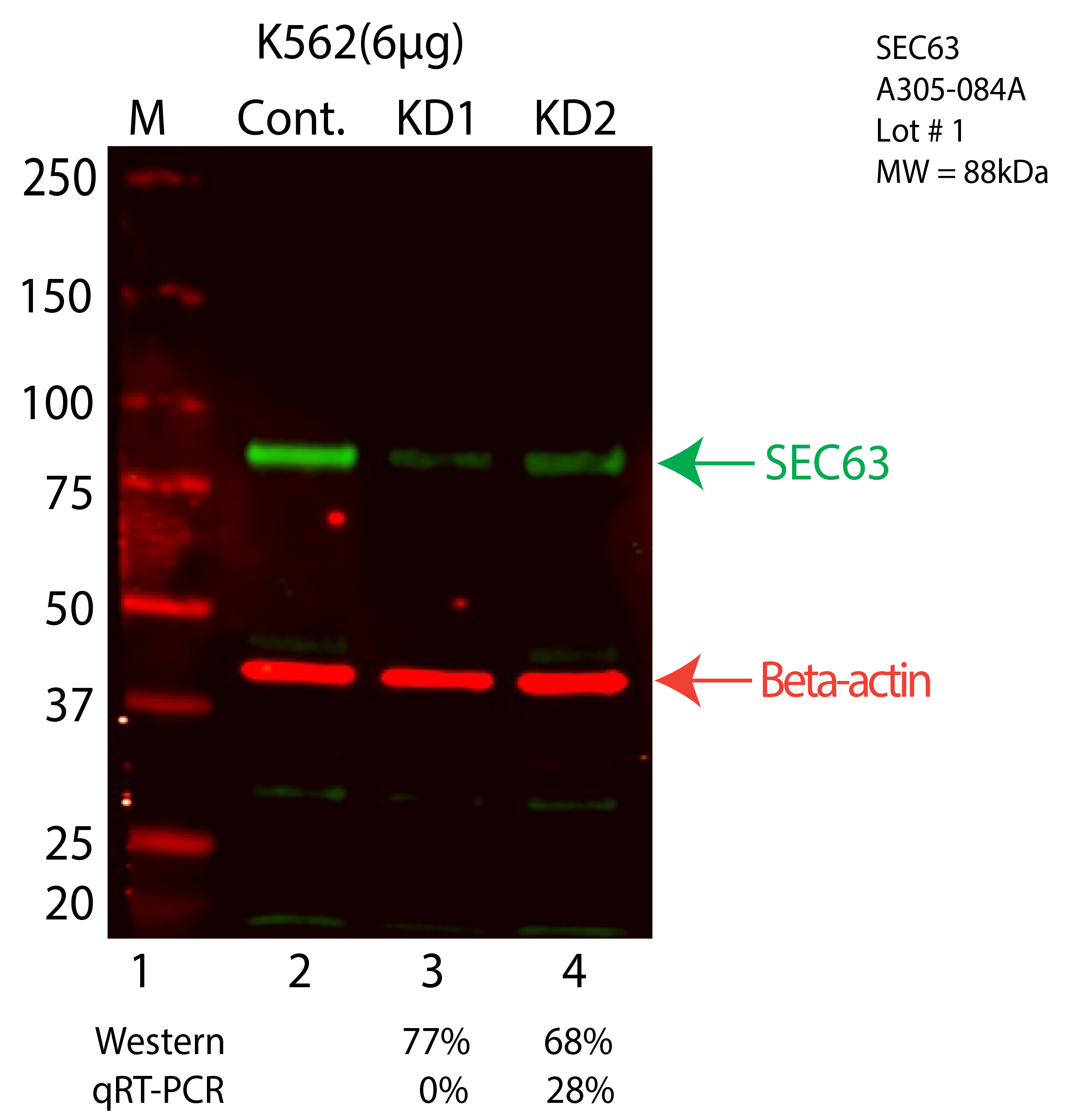 SEC63-K562-CRISPR-A305-084A.png<br>Caption: Western blot following CRISPR against SEC63 in K562 whole cell lysate using SEC63 specific antibody. Lane 1 is a ladder, lane 2 is K562 non-targeting control knockdown, lane 3 and 4 are two different CRISPR against SEC63. SEC63 protein appears as the green arrow, Beta-actin serves as a control and appears in red arrow.