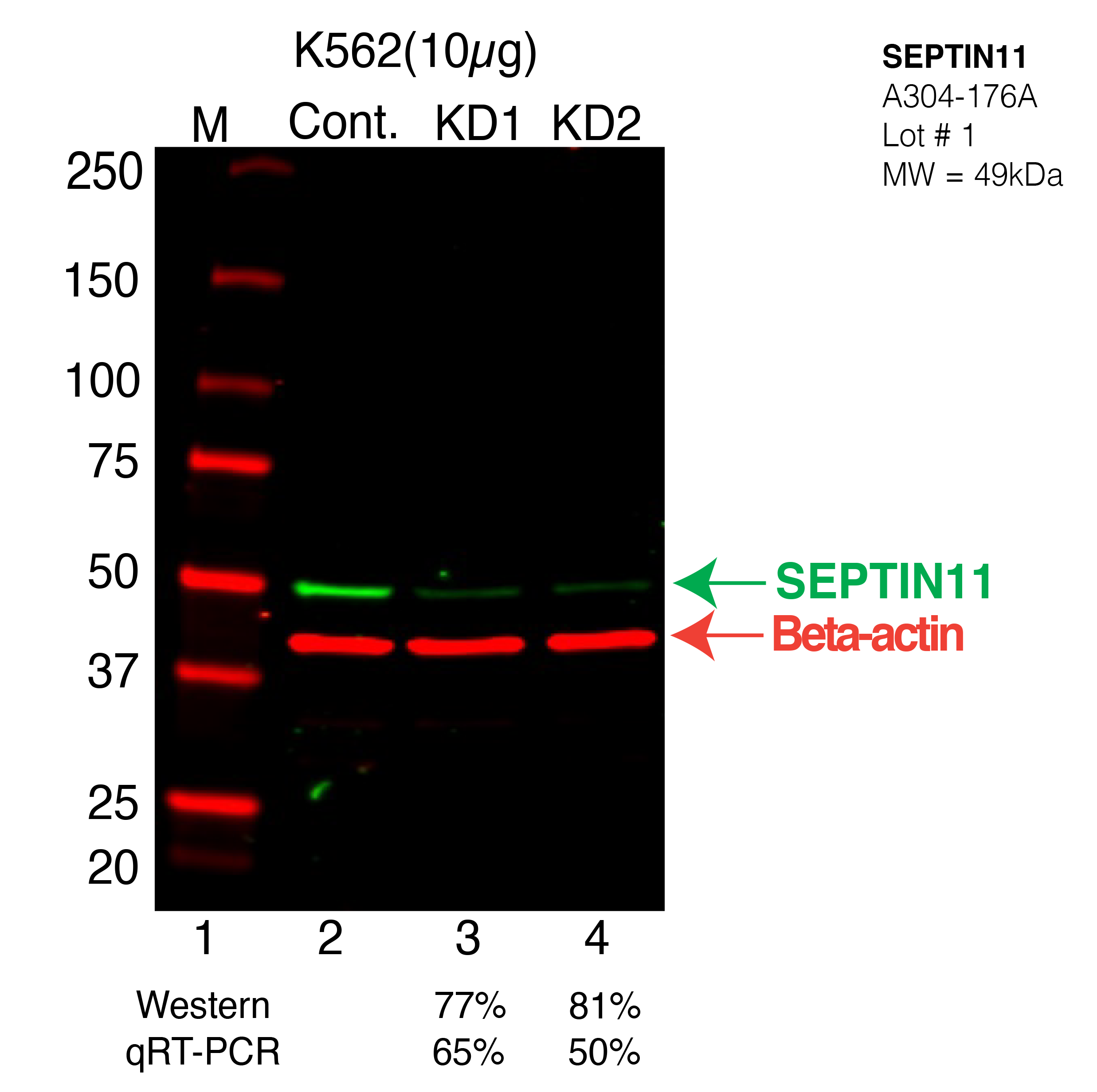 SEPTIN11-K562-CRISPR-A304-176A.png<br>Caption: Western blot following CRISPR against SEPT11 in K562 whole cell lysate using SEPT11 specific antibody. Lane 1 is a ladder, lane 2 is K562 non-targeting control knockdown, lane 3 and 4 are two different CRISPR against SEPT11. SEPT11 protein appears as the green arrow, Beta-actin serves as a control and appears in red arrow.