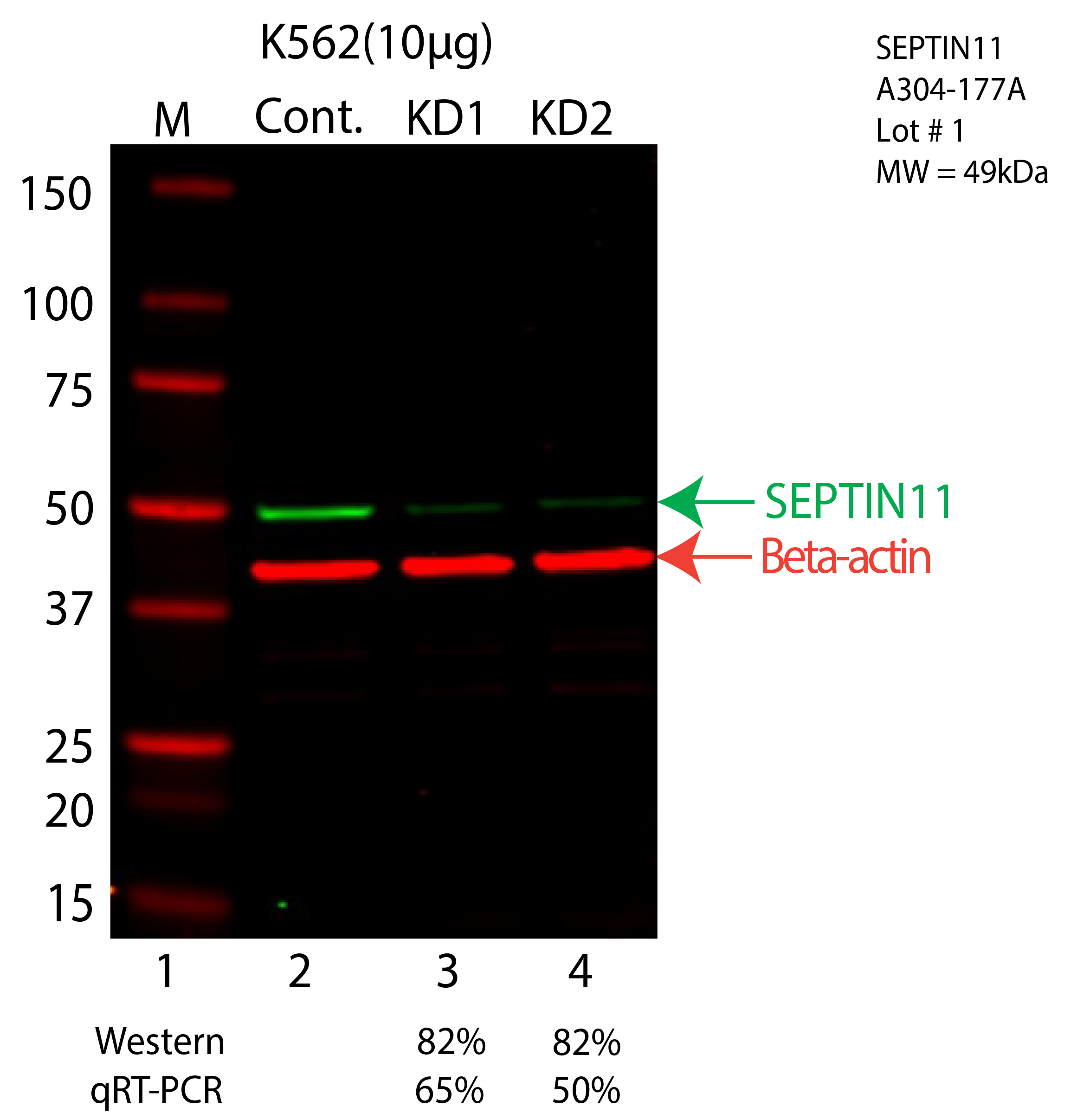 SEPTIN11-K562-CRISPR-A304-177A.png<br>Caption: Western blot following CRISPR against SEPT11 in K562 whole cell lysate using SEPT11 specific antibody. Lane 1 is a ladder, lane 2 is K562 non-targeting control knockdown, lane 3 and 4 are two different CRISPR against SEPT11. SEPT11 protein appears as the green arrow, Beta-actin serves as a control and appears in red arrow.