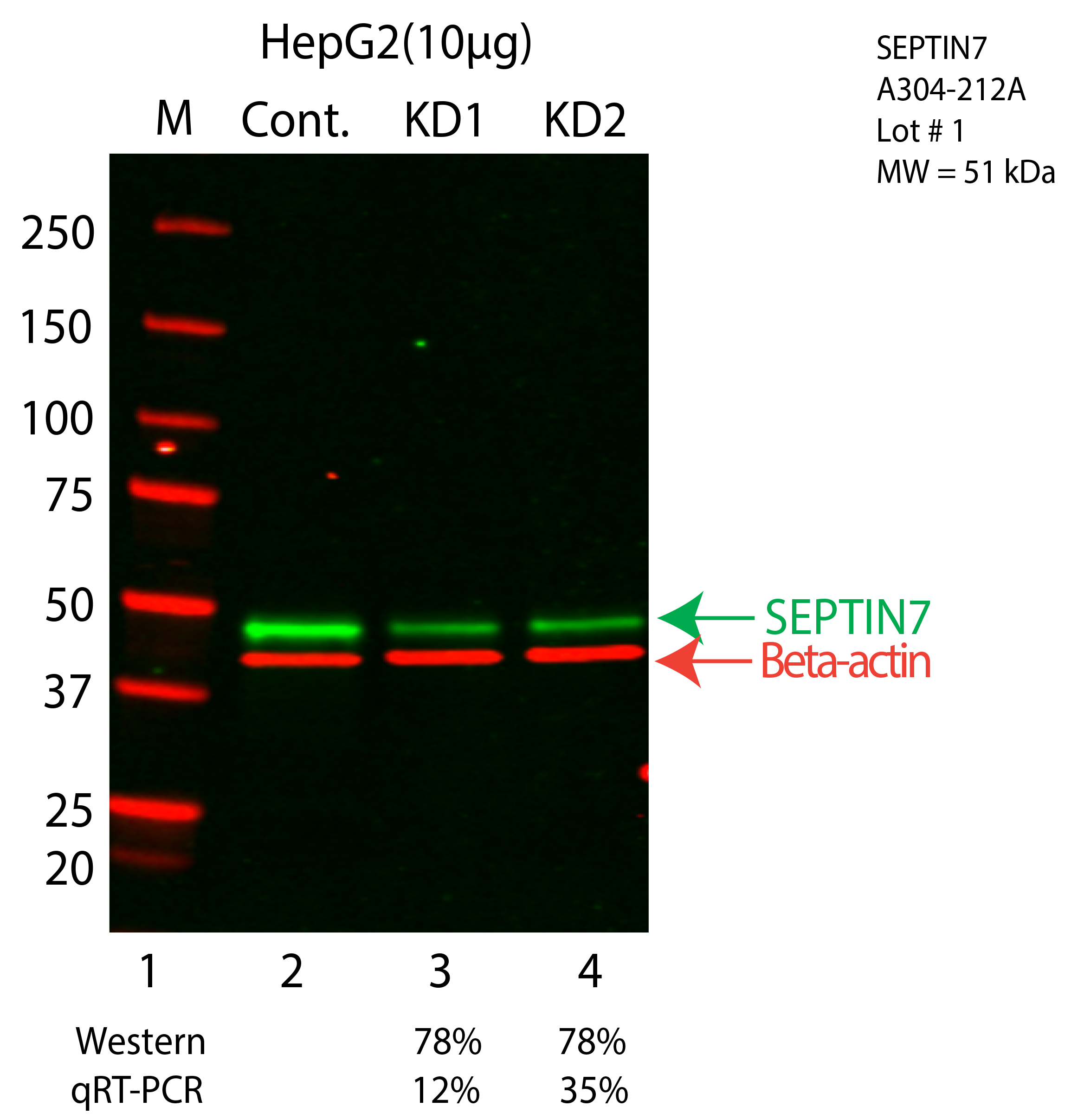 SEPTIN7-HEPG2-CRISPR-A304-212A.png<br>Caption: Western blot following CRISPR against SEPT7 in HepG2 whole cell lysate using SEPT7 specific antibody. Lane 1 is a ladder, lane 2 is HepG2 non-targeting control knockdown, lane 3 and 4 are two different CRISPR against SEPT7. SEPT7 protein appears as the green arrow, Beta-actin serves as a control and appears in red arrow.