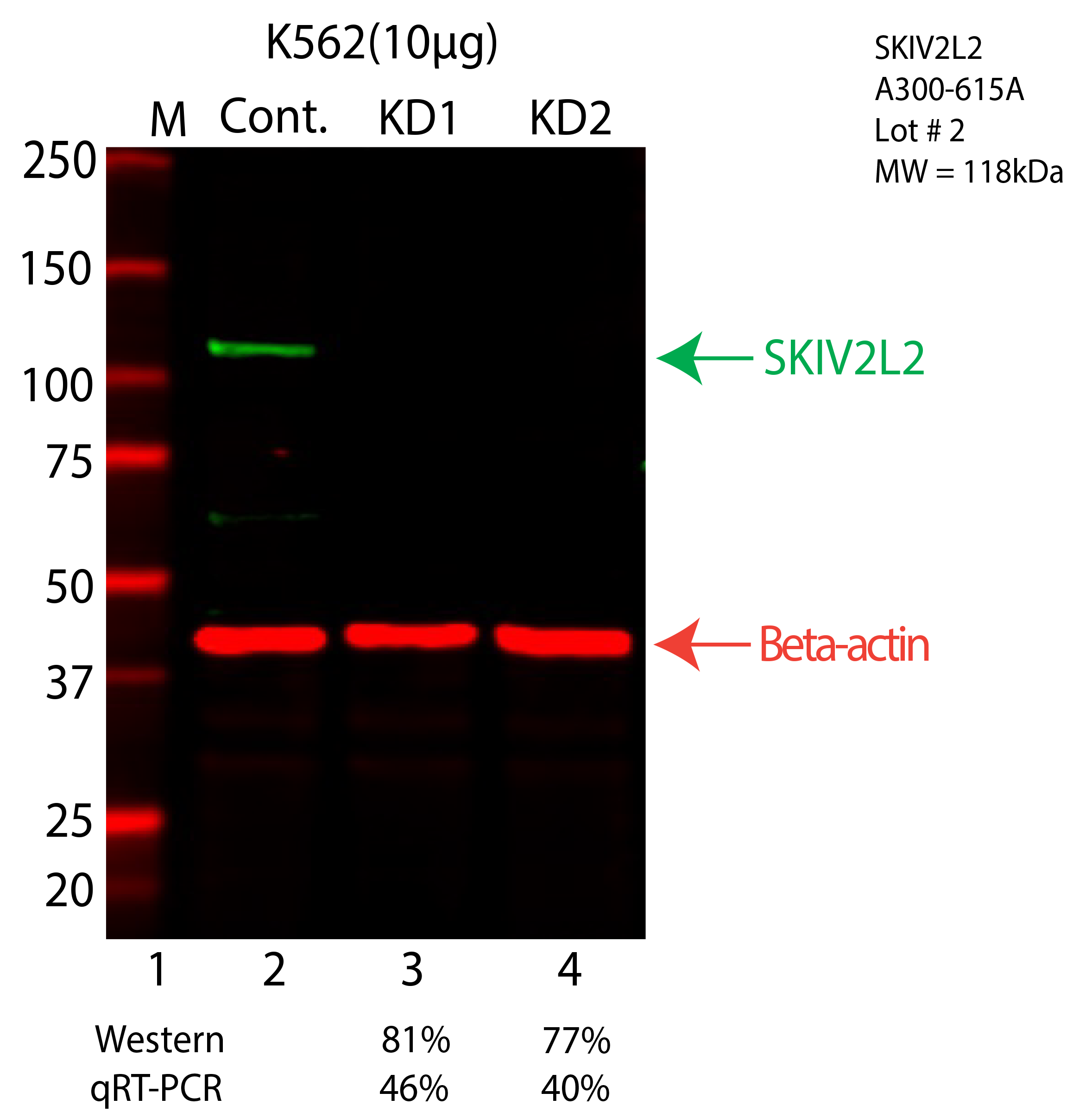 SKIV2L2-K562-CRISPR-A300-615A.png<br>Caption: Western blot following CRISPR against MTREX in K562 whole cell lysate using MTREX specific antibody. Lane 1 is a ladder, lane 2 is K562 non-targeting control knockdown, lane 3 and 4 are two different CRISPR against MTREX. MTREX protein appears as the green arrow, Beta-actin serves as a control and appears in red arrow.