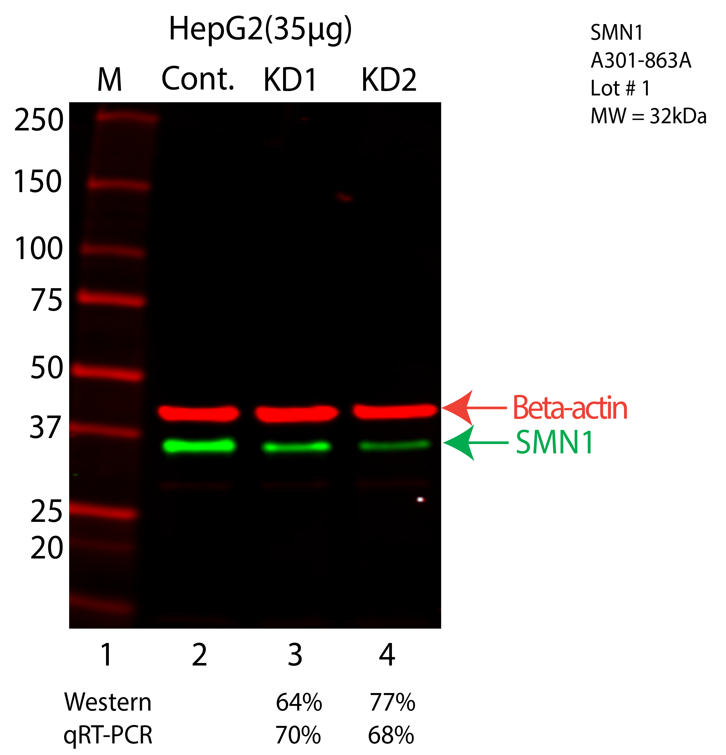 SMN1-HEPG2-A301-863A.png<br>Caption: Western blot following shRNA against SMN1 in HepG2 whole cell lysate using SMN1 specific antibody. Lane 1 is a ladder, lane 2 is HepG2 non-targeting control knockdown, lane 3 and 4 are two different shRNA against SMN1. SMN1 protein appears as the green arrow, Beta-actin serves as a control and appears in red arrow.