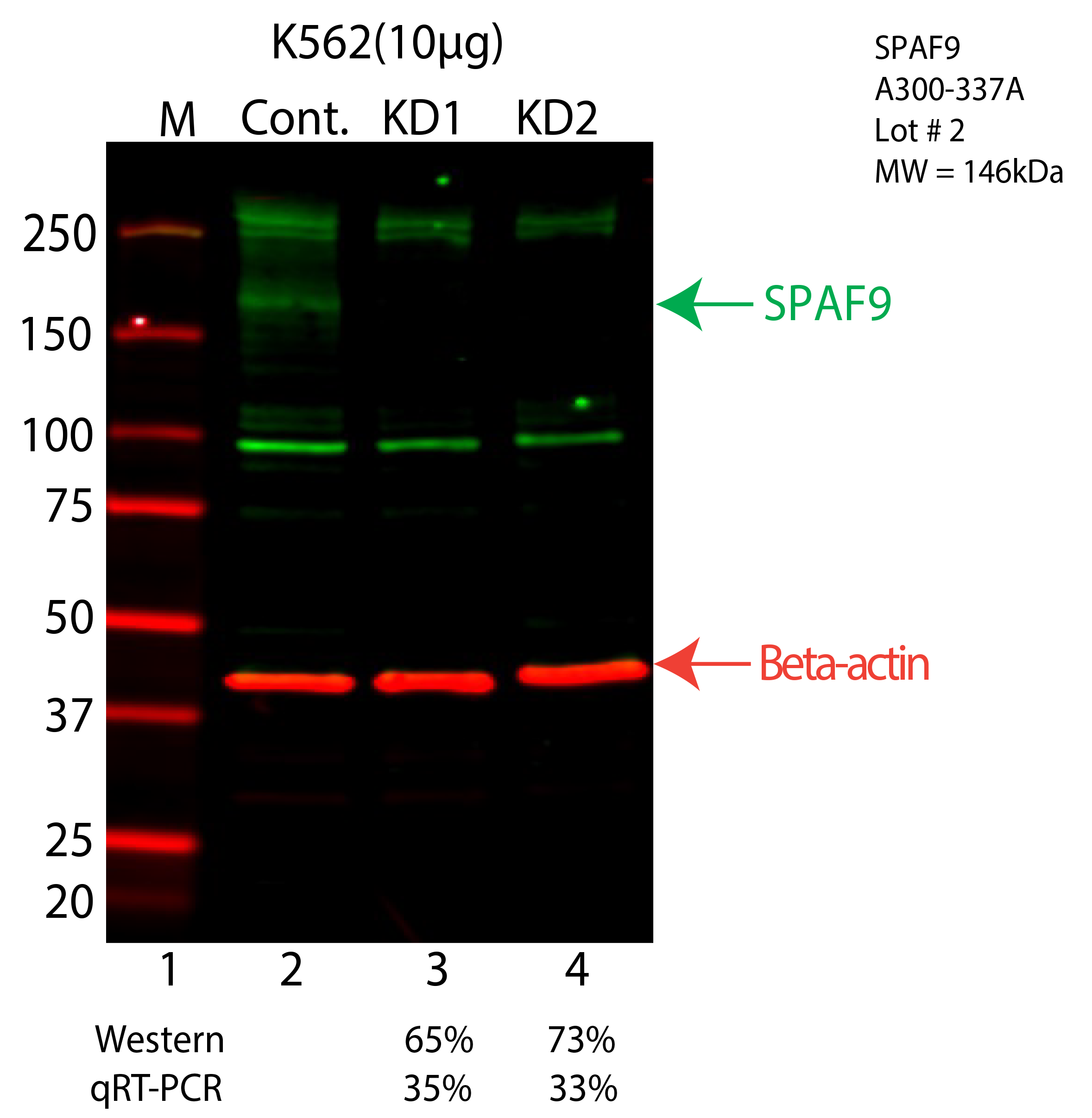 SPAG9-K562-CRISPR-A300-337A.png<br>Caption: Western blot following CRISPR against SPAG9 in K562 whole cell lysate using SPAG9 specific antibody. Lane 1 is a ladder, lane 2 is K562 non-targeting control knockdown, lane 3 and 4 are two different CRISPR against SPAG9. SPAG9 protein appears as the green arrow, Beta-actin serves as a control and appears in red arrow.