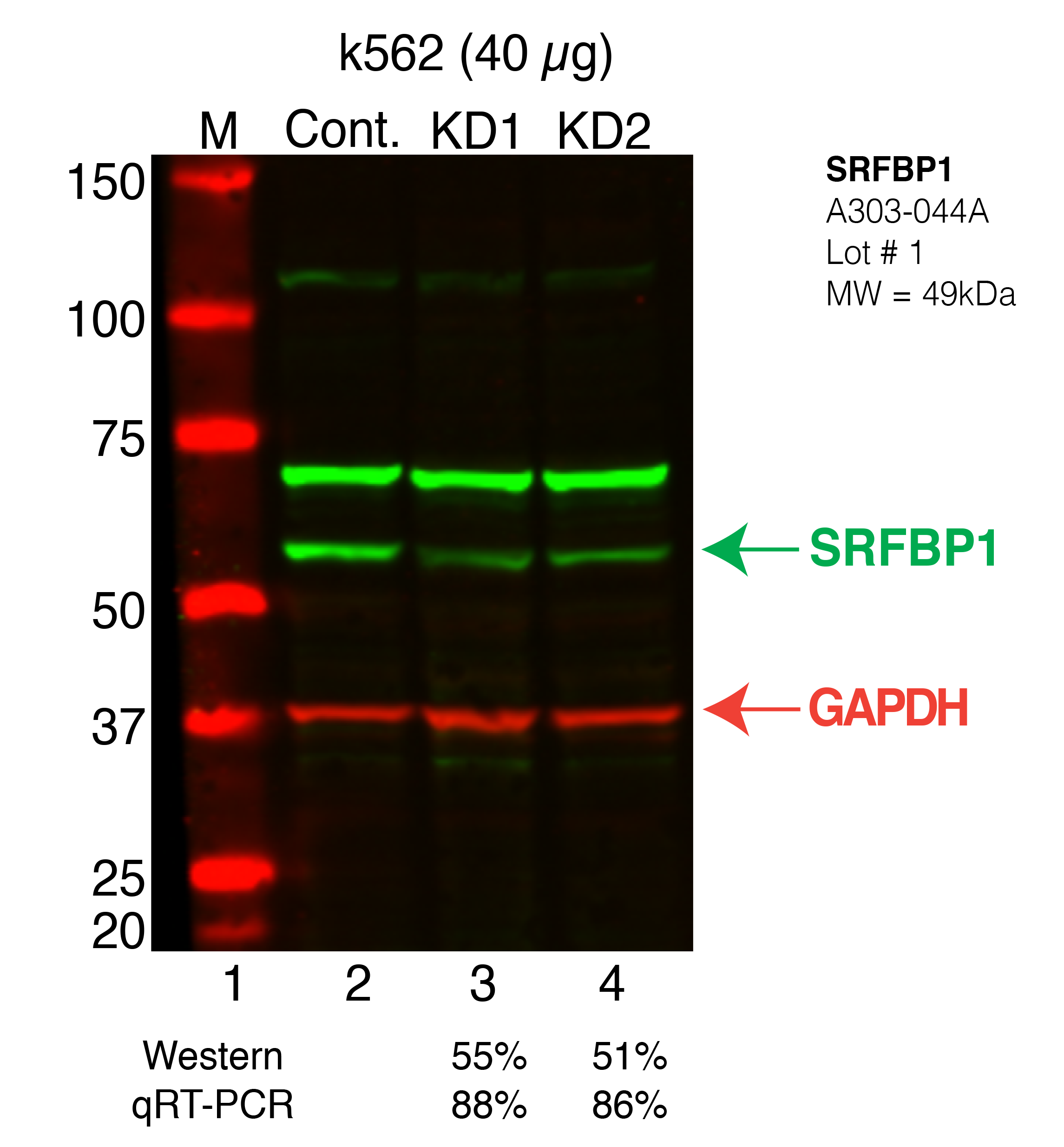 SRFBP1-K562.png<br>Caption: Western blot following shRNA against SRFBP1 in k562 whole cell lysate using SRFBP1 specific antibody. Lane 1 is a ladder, lane 2 is k562 non-targeting control knockdown, lane 3 and 4 are two different shRNAs against SRFBP1. SRFBP1 protein appears as the green band, while GAPDH serves as a control and appears in red.