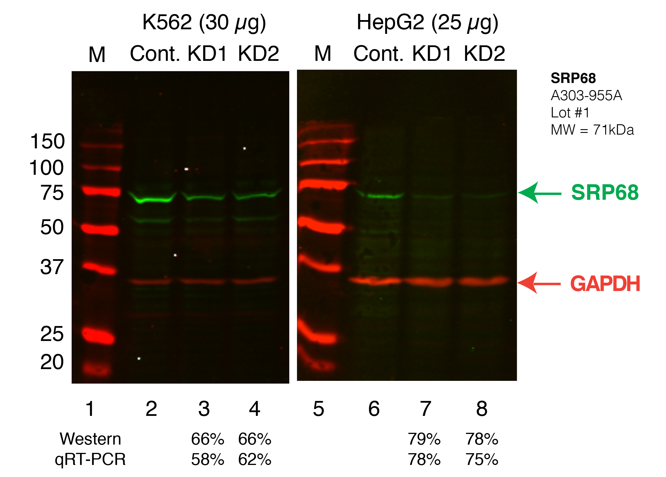 SRP68_Secondary_Western.png<br>Caption: Western blot following shRNA against SRP68 in K562 and HepG2 whole cell lysate using SRP68 specific antibody. Lane 1 is a ladder, lane 2 is K562 non-targeting control knockdown, lane 2 and 3 are two different shRNAs against SRP68. Lanes 5-7 follow the same pattern, but in HepG2. SRP68 protein appears as the green band, GAPDH serves as a control and appears in red.