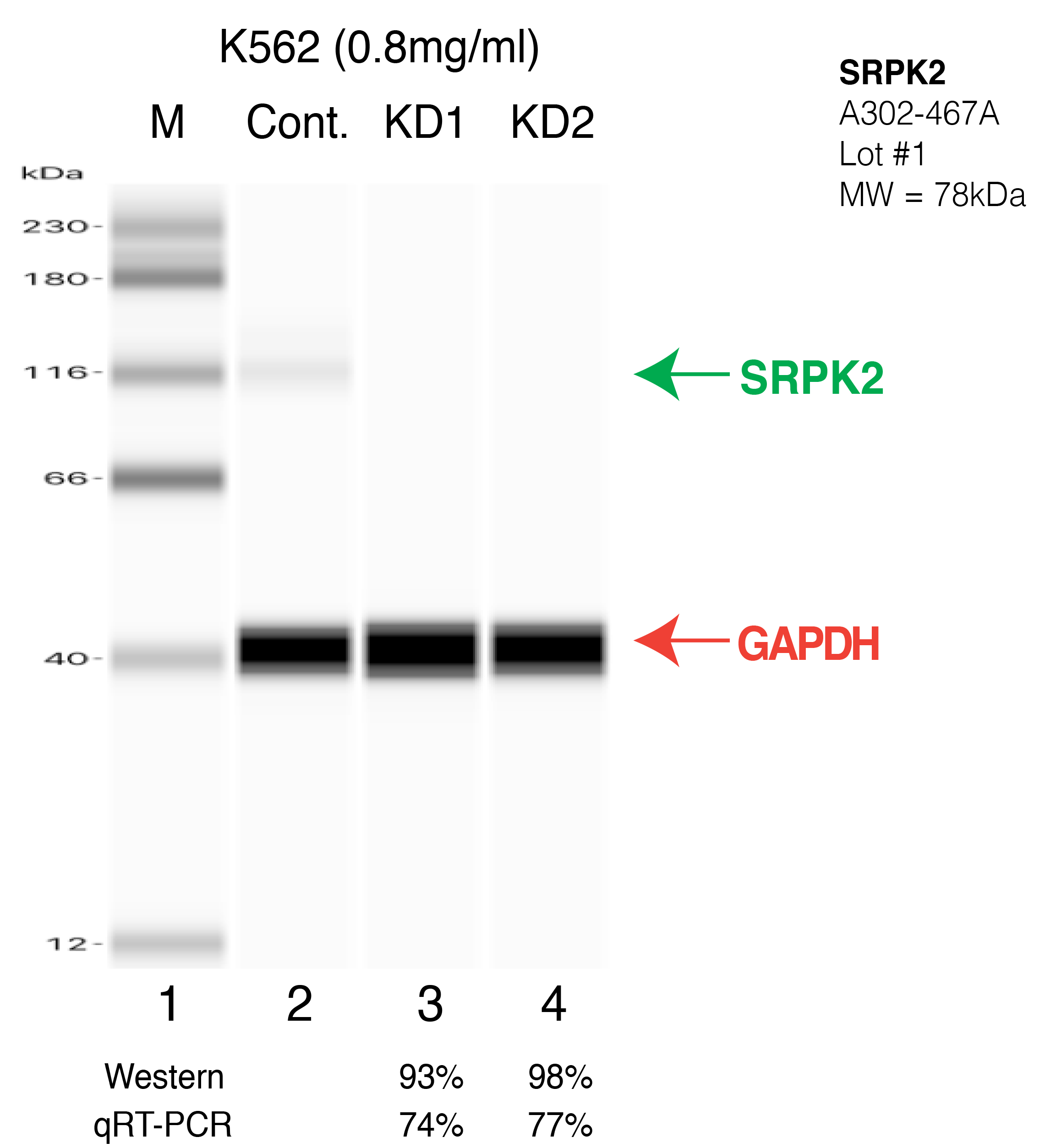 SRPK2-HEPG2-CRISPR.png<br>Caption: Western blot following CRISPR against SRPK2 in HepG2 whole cell lysate using SRPK2 specific antibody. Lane 1 is a ladder, lane 2 is HepG2 non-targeting control knockdown, lane 3 and 4 are two different CRISPR against SRPK2. SRPK2 protein appears as the green arrow, GAPDH serves as a control and appears in red arrow.