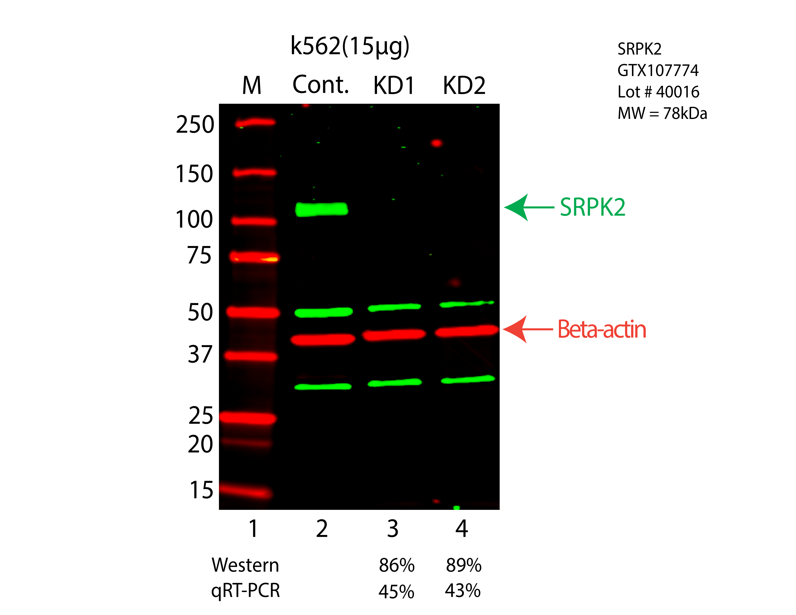 SRPK2-K562-CRISPR-GTX107774.png<br>Caption: Western blot following shRNA against SRPK2 in K562 whole cell lysate using SRPK2 specific antibody. Lane 1 is a ladder, lane 2 is K562 non-targeting control knockdown, lane 3 and 4 are two different shRNA against SRPK2. SRPK2 protein appears as the green arrow, Beta-actin serves as a control and appears in red arrow.