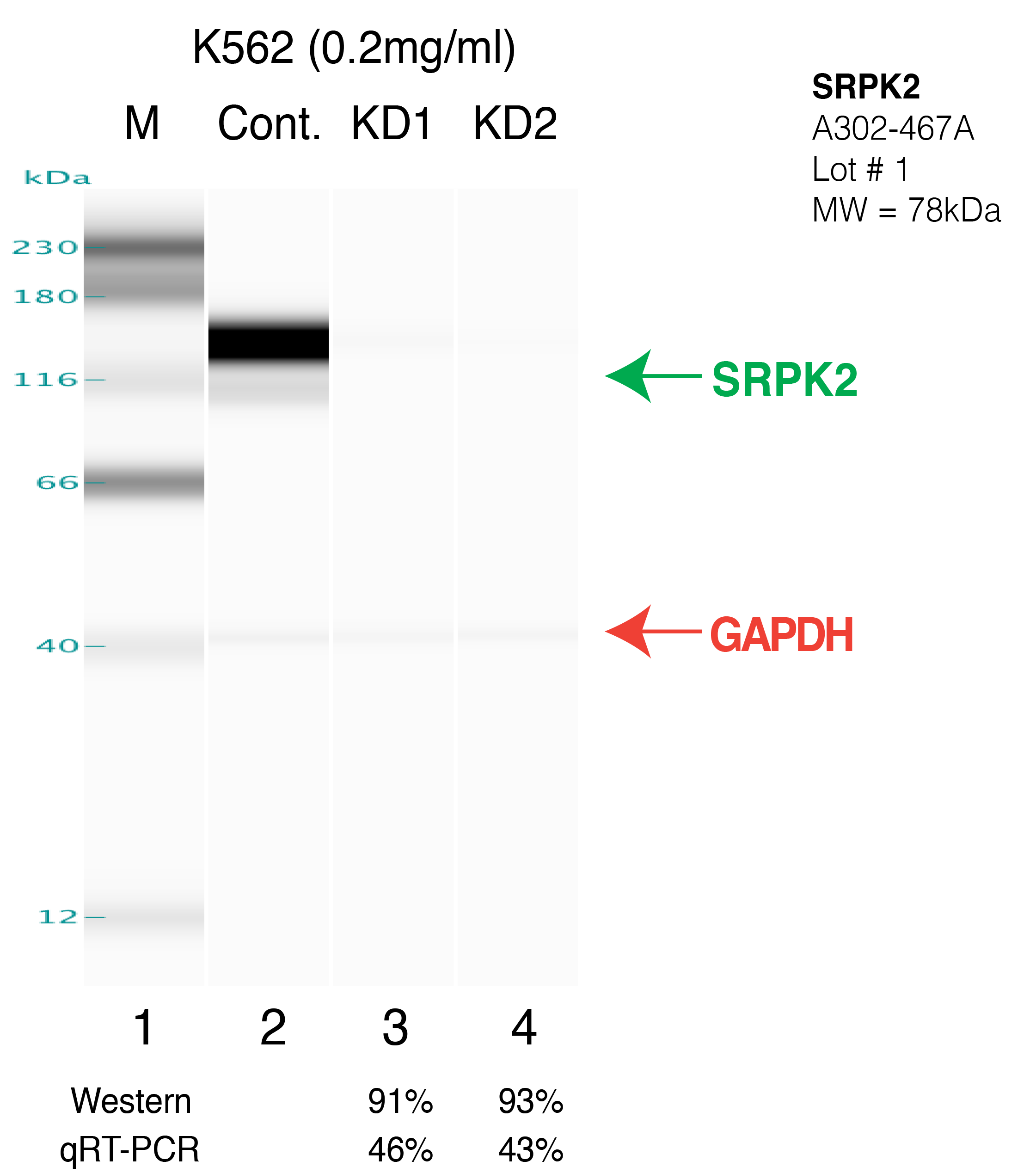 SRPK2-K562.png<br>Caption: Western blot following shRNA against SRPK2 in K562 whole cell lysate using SRPK2 specific antibody. Lane 1 is a ladder, lane 2 is K562 non-targeting control knockdown, lane 3 and 4 are two different shRNAs against SRPK2. SRPK2 serves as a control and appears in red arrow.GAPDH serves as a control and appears in red arrow.