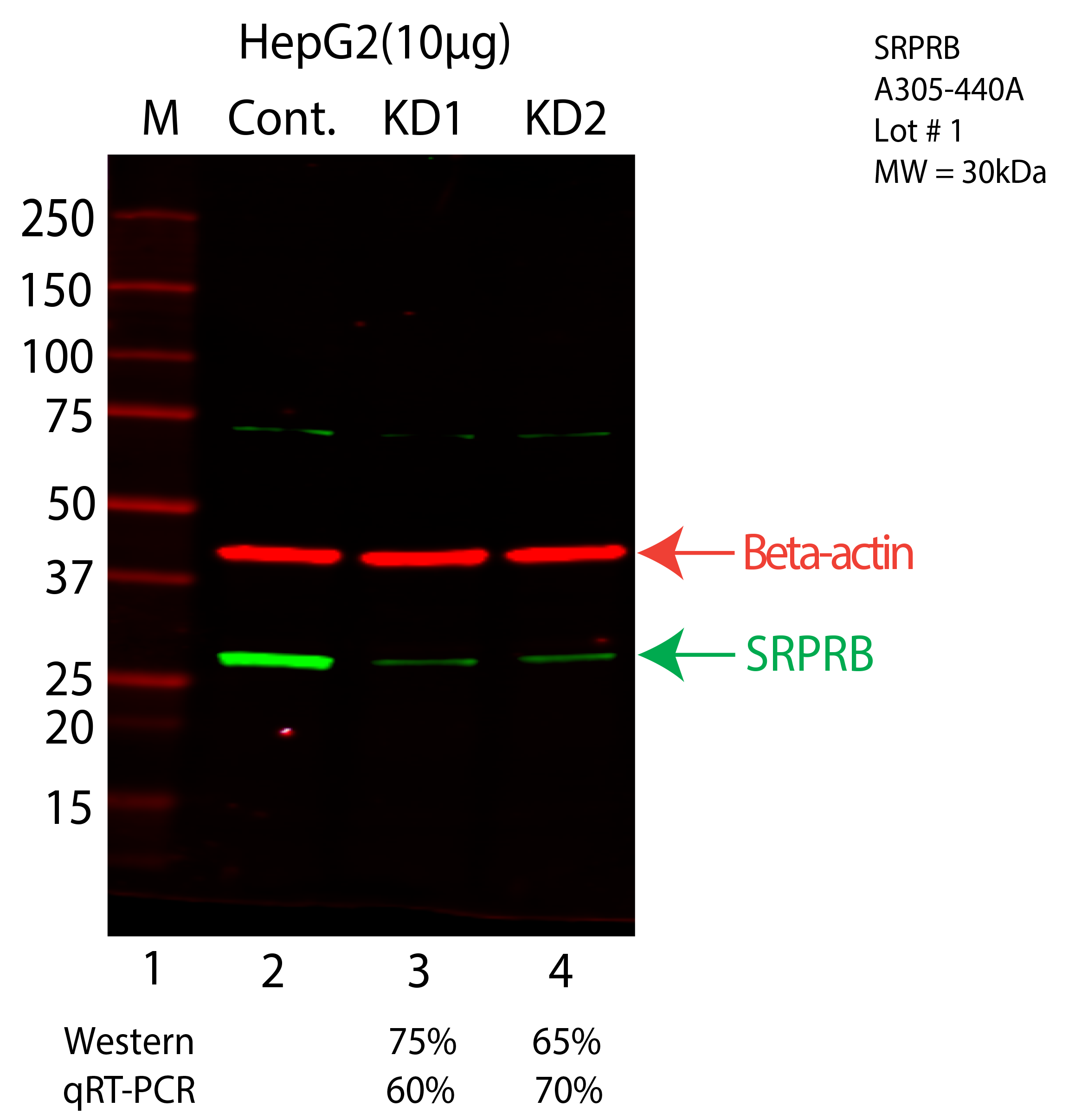 SRPRB-HEPG2-CRISPR-A305-440A.png<br>Caption: Western blot following CRISPR against SRPRB in HepG2 whole cell lysate using SRPRB specific antibody. Lane 1 is a ladder, lane 2 is HepG2 non-targeting control knockdown, lane 3 and 4 are two different CRISPR against SRPRB. SRPRB protein appears as the green arrow, Beta-actin serves as a control and appears in red arrow.