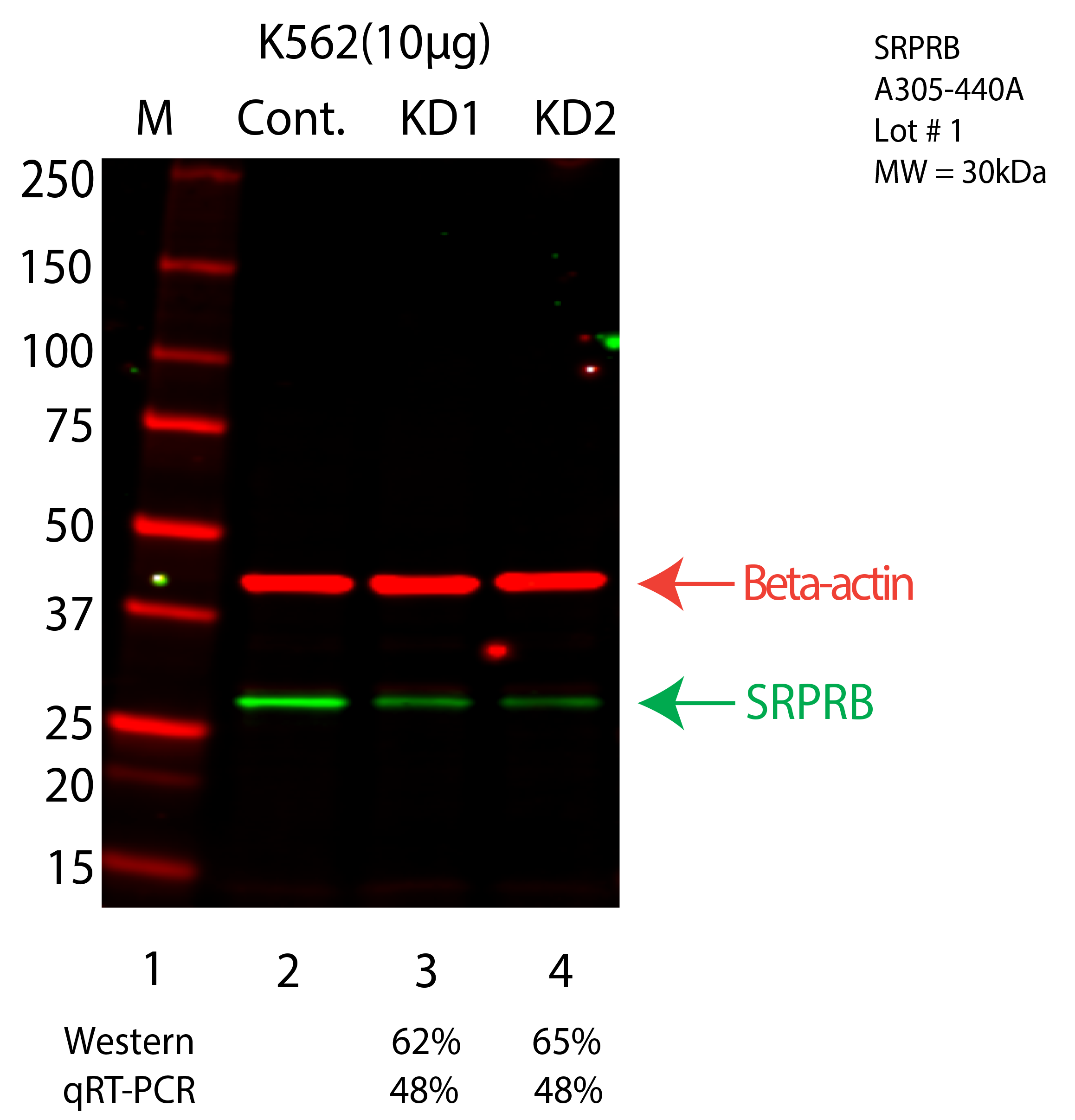 SRPRB-K562-CRISPR-A305-440A.png<br>Caption: Western blot following CRISPR against SRPRB in K562 whole cell lysate using SRPRB specific antibody. Lane 1 is a ladder, lane 2 is K562 non-targeting control knockdown, lane 3 and 4 are two different CRISPR against SRPRB. SRPRB protein appears as the green arrow, Beta-actin serves as a control and appears in red arrow.