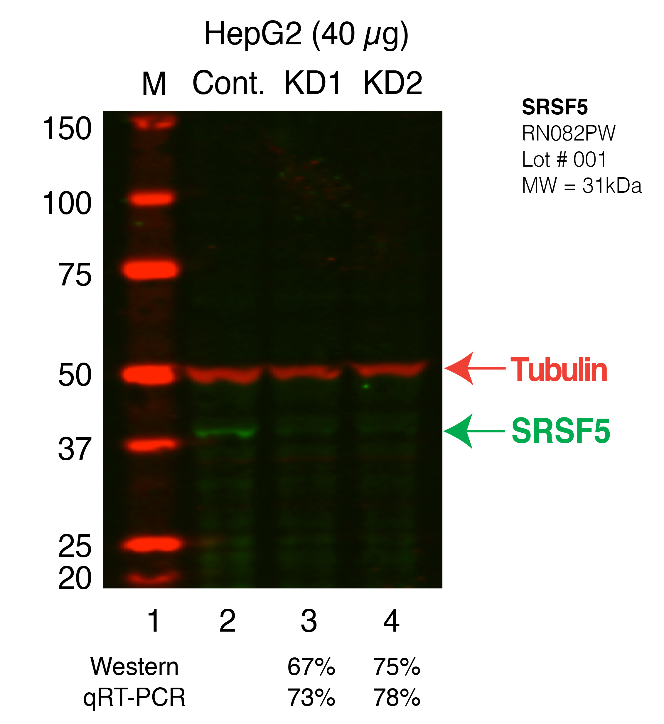 SRSF5-HEPG2_Secondary_Western.png<br>Caption: Western blot following shRNA against SRSF5 in HepG2 whole cell lysate using SRSF5 specific antibody. Lane 1 is a ladder, lane 2 is HepG2 non-targeting control knockdown, lane 3 and 4 are two different shRNAs against SRSF5.SRSF5 protein appears as the green band, Tubulin serves as a control and appears in red.