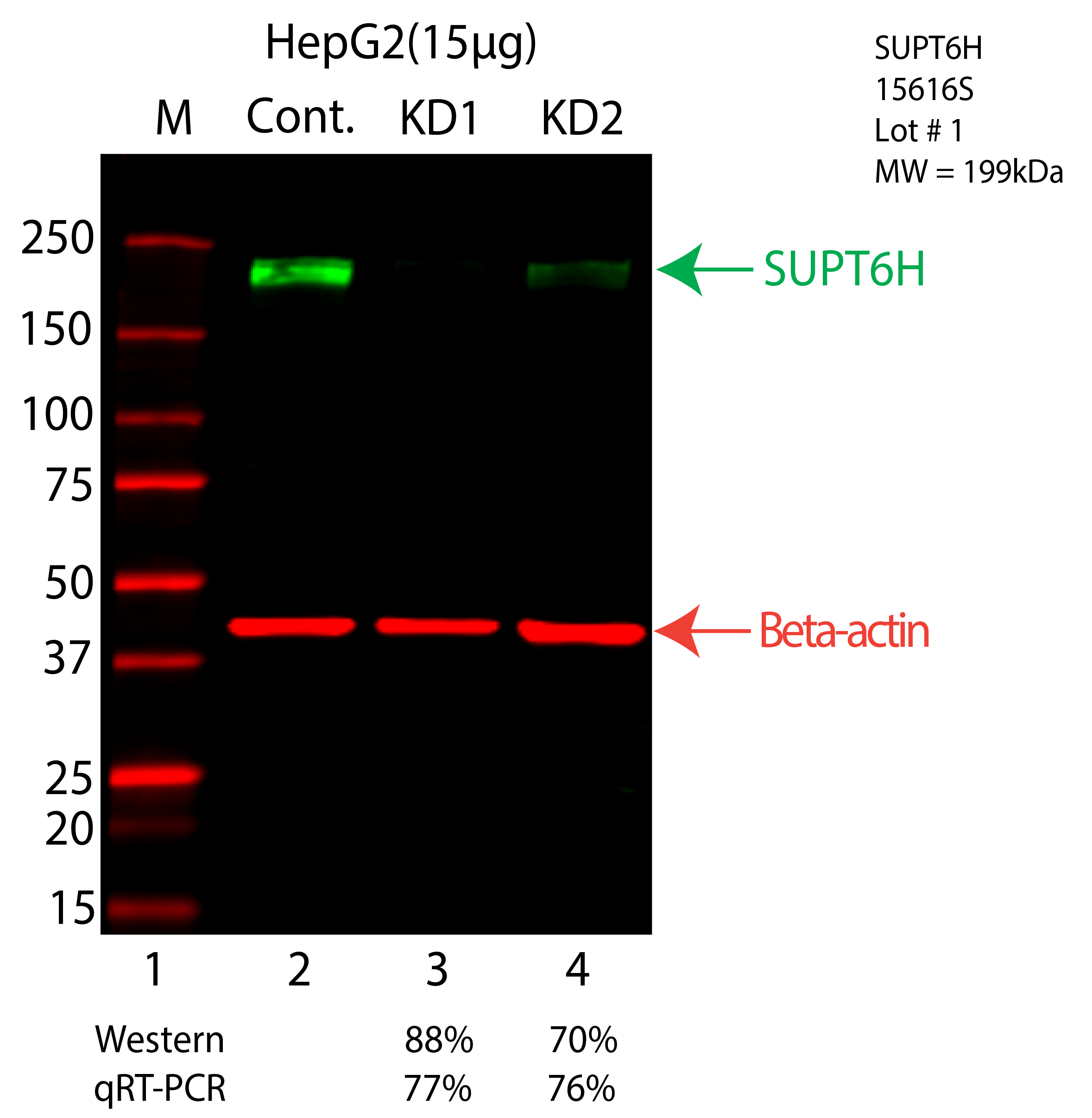 SUPT6H-HEPG2-15616S.png<br>Caption: Western blot following shRNA against SUPT6H in HepG2 whole cell lysate using SUPT6H specific antibody. Lane 1 is a ladder, lane 2 is HepG2 non-targeting control knockdown, lane 3 and 4 are two different shRNA against SUPT6H. SUPT6H protein appears as the green arrow, Beta-actin serves as a control and appears in red arrow.