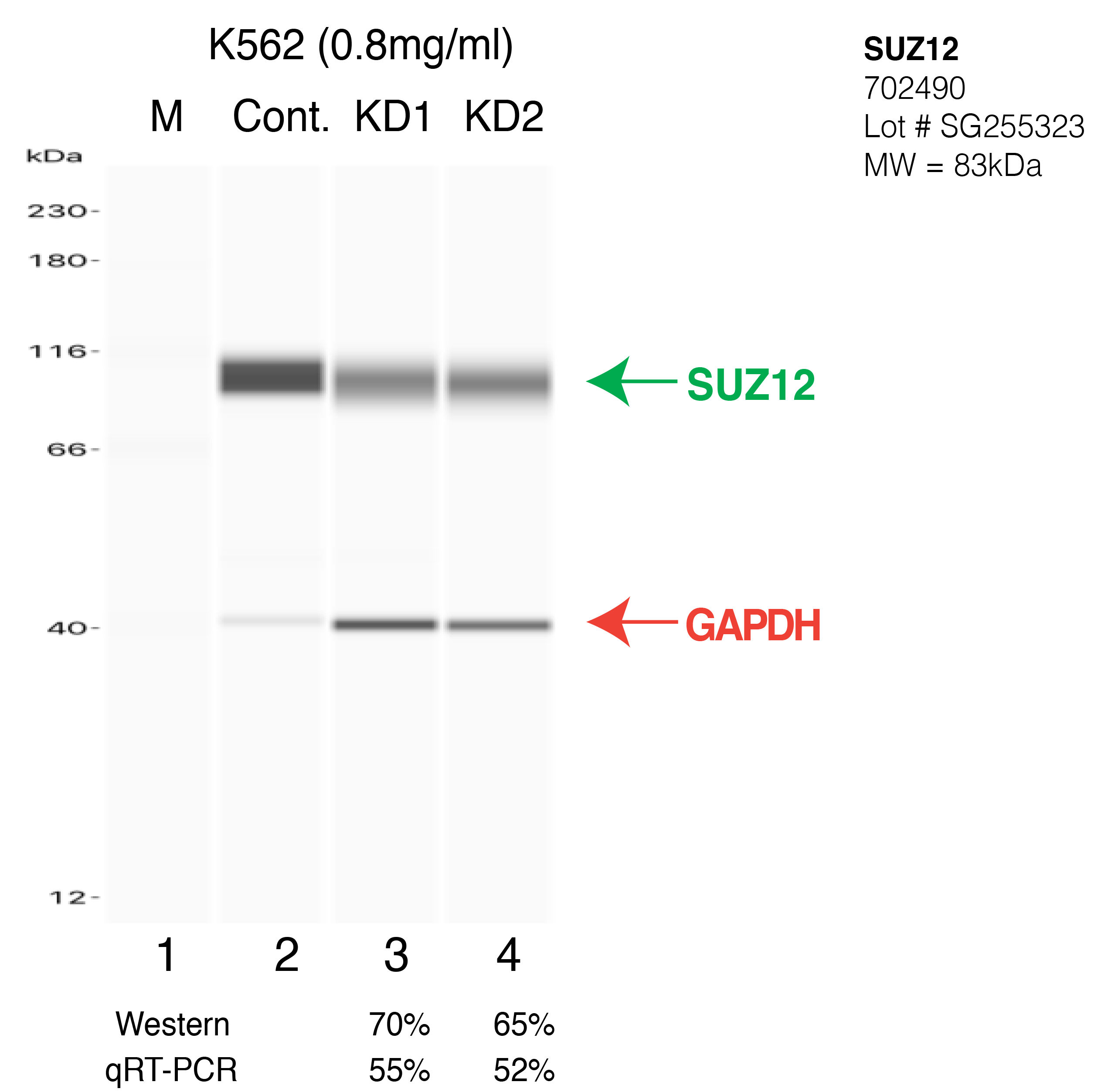 SUZ12-K562-CRISPR-702490.png<br>Caption: Western blot following CRISPR against SUZ12 in K562 whole cell lysate using SUZ12 specific antibody. Lane 1 is a ladder, lane 2 is K562 non-targeting control knockdown, lane 3 and 4 are two different CRISPR against SUZ12. SUZ12 protein appears as the green arrow, GAPDH serves as a control and appears in red arrow.